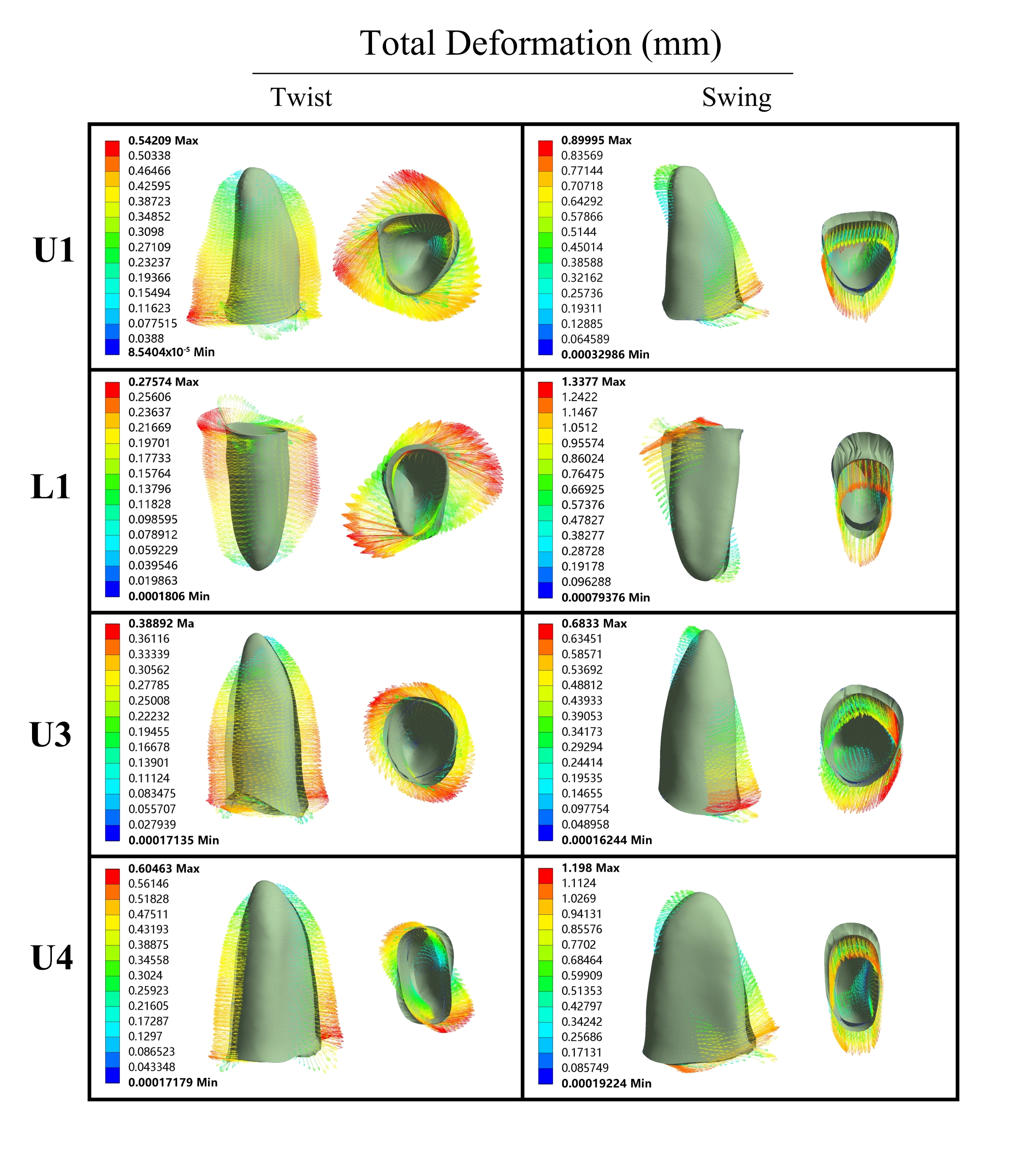 Total deformation in the periodontal ligament. The total 
deformation of the PDL was more uniform during torsional loading, while the swing 
method caused deformation primarily at the cervical and apex regions of the PDL. 
U1: upper jaw incisor; L1: lower jaw incisor; U3: upper jaw canine; U4: upper jaw 
premolar; Max: maximum; Min: minimum.