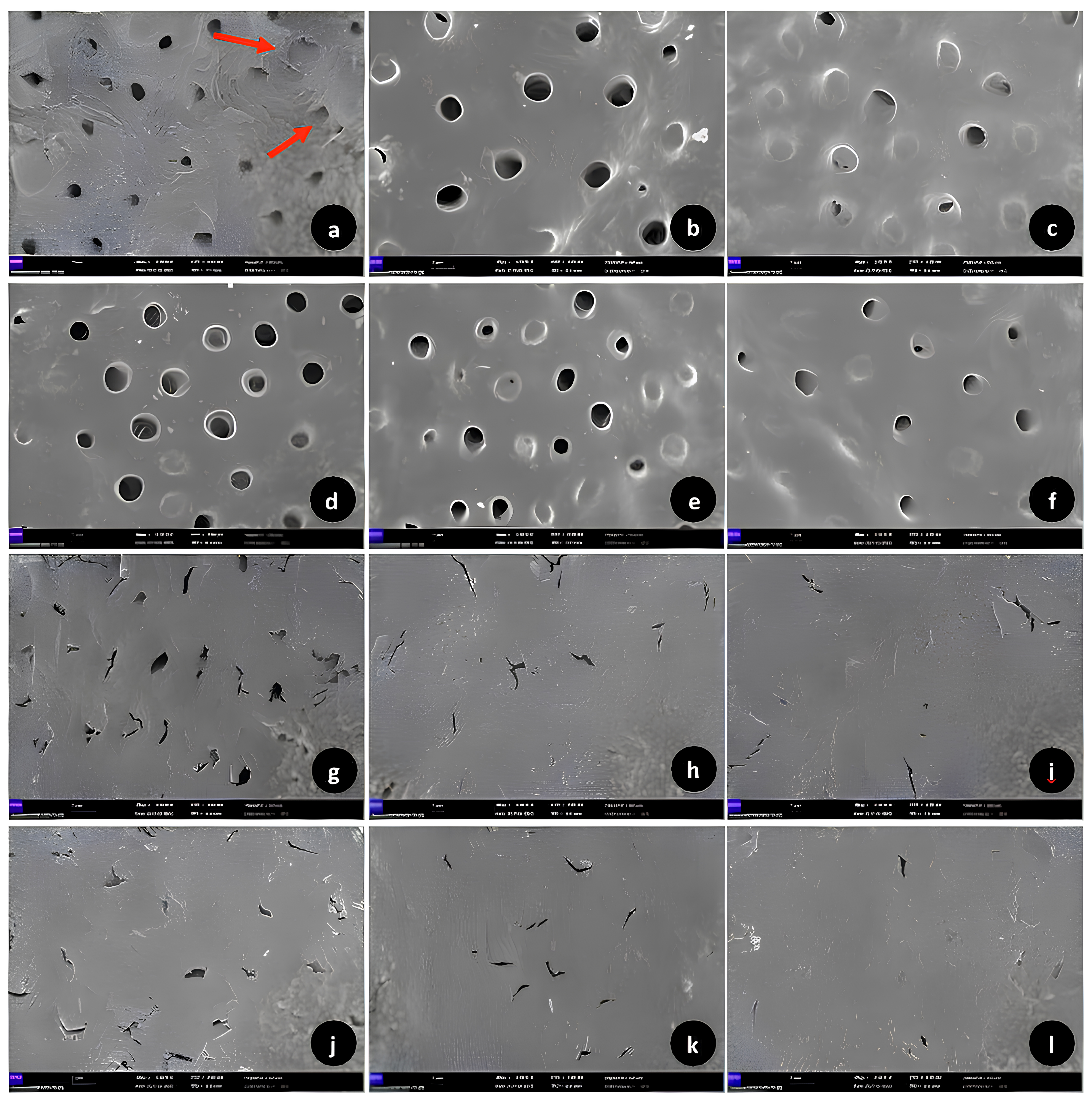 Representative SEM images (×3500 mag.) of the 
root surfaces of the tooth samples in the K-File group. Representative SEM 
images of root samples applied with 5% EDTA solution (a–c). Coronal third (a, 
score 1), middle third (b, score 1) and apical third (c, score 1). Erosive 
defects in the inter- and peritubular dentin in coronal third (a) are shown 
marked with a red arrow. Representative SEM images of root samples applied with 
6% CA solution (d–f). Coronal third (d, score 1), middle third (e, score 1) and 
apical third (f, score 1). Representative SEM images of root samples applied with 
1% NaOCl solution (g–i). Coronal third (g, score 2), middle third (h, score 2) 
and apical third (i, score 2). Representative SEM images of root samples applied 
with 0.9% PS solution (Control group) (j–l). Coronal third (j, score 2), middle 
third (k, score 2) and apical third (l, score 2).