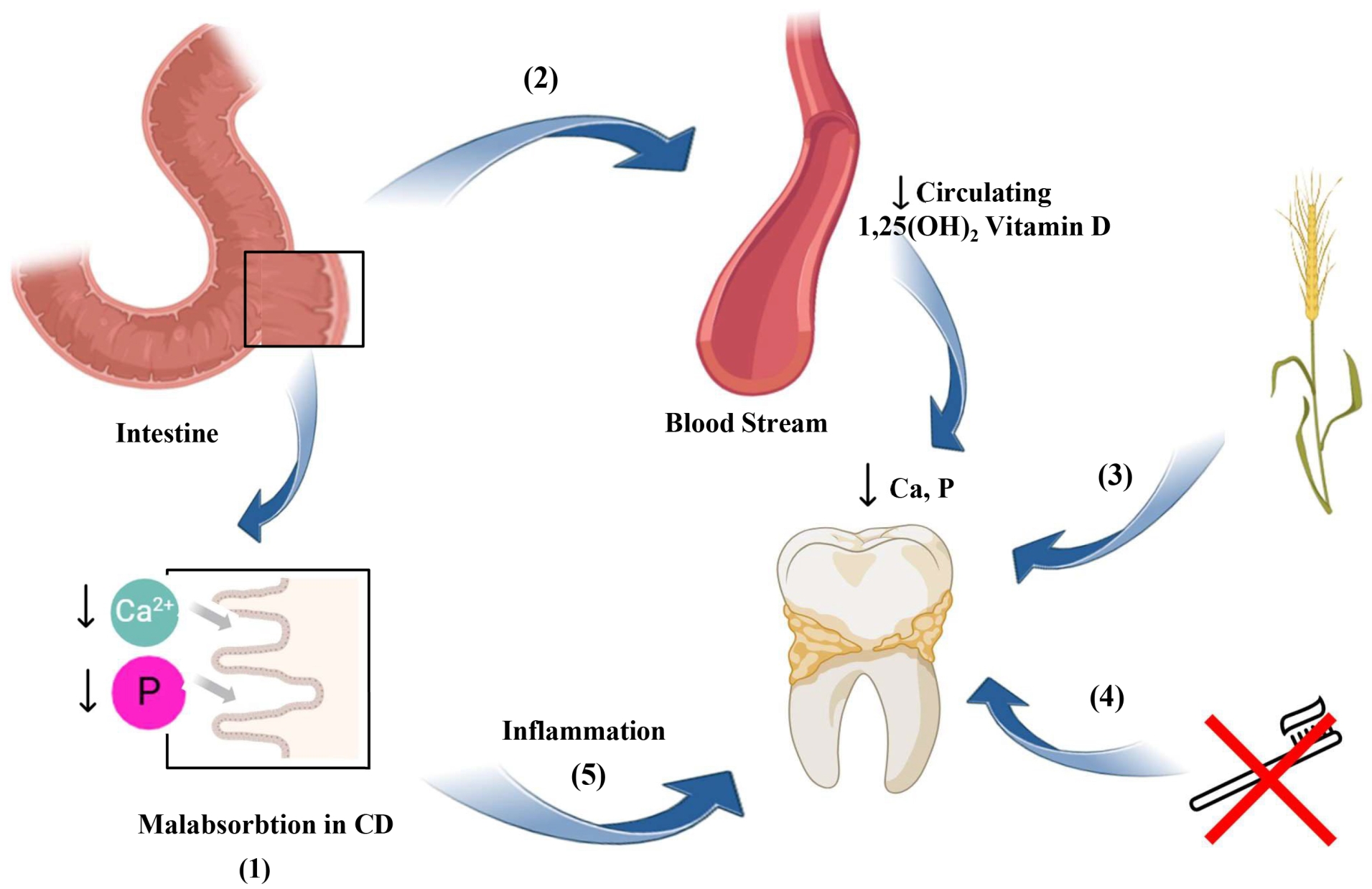 Possible mechanisms explaining increased dental caries and
higher. OH: hydroxy; Ca: Calcium; P: Phosphorus; CD: Celiac Disease.