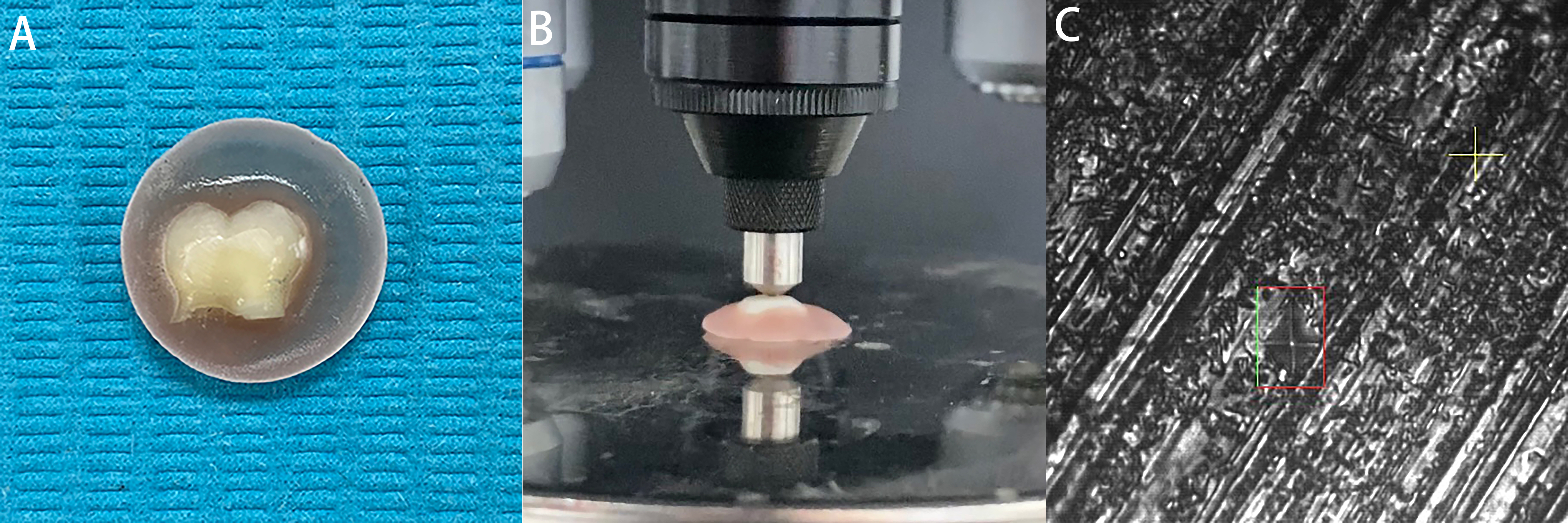 Microhardness measurement using Vickers hardness testing
machine. (A) Crown fixed in an acrylic mold with its buccal surface exposed. (B)
Testing the microhardness of enamel surface. (C) Diamond indenter on the enamel
surface.