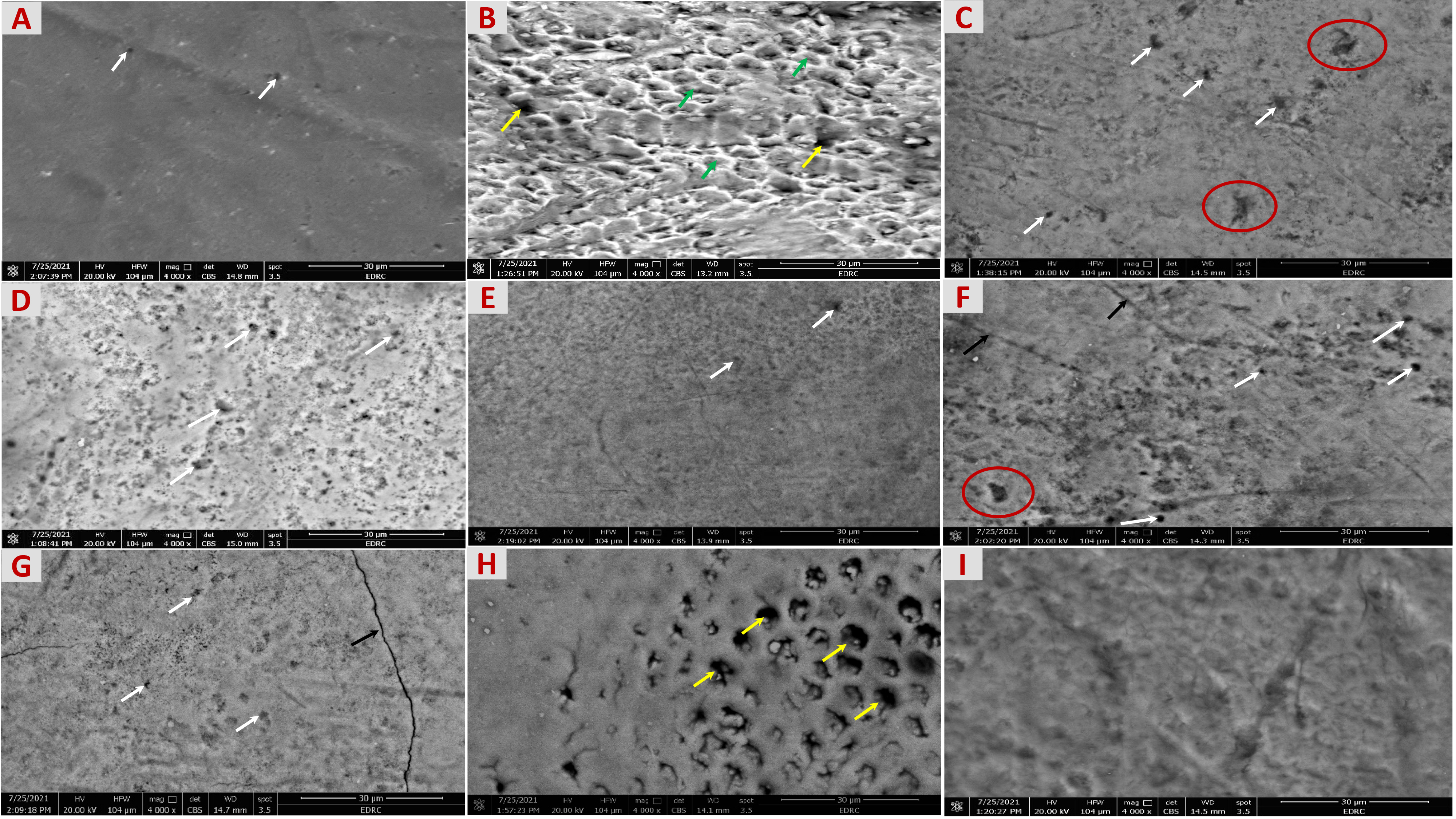 SEM micrographs of the enamel surfaces after immersion in
different pediatric medications for 24 hours at magnification ×4000.
(A) Artificial Saliva (control group) revealed a relatively smooth enamel surface
with minimal porosity (white arrows) with no obvious evidence of erosion. (B)
Ospen group demonstrated noticeable focal areas with a fish-scale appearance on
the enamel surface (green arrows), along with exposed dentin where dentinal
tubules were visible (yellow arrows), indicating enamel demineralization. (C)
Exjade group displayed a rough, multipored enamel surface (white arrows) with
structural enamel loss (red circles) but no dentin exposure. (D) Feromin group
displayed a multipored (white arrows), irregular, and rough enamel surface,
denoting structural enamel loss. (E) Predo group revealed an almost uniformly
smooth enamel microstructure with few pores (white arrows) and no signs of
erosion. (F) Bactrim group displayed a pitted and cracked enamel surface (black
arrows) with numerous pores of varying diameters (white arrows), indicating
structural enamel loss (red circles). (G) Keppra group revealed a relatively
smooth enamel surface with some porosity (white arrows) and minimal cracks (black
arrow). (H) Risperdal group displayed a rough and pitted enamel surface with
exposed dentin and visible dentinal tubules of varying diameters (yellow arrows),
indicating structural enamel loss and signs of erosion. (I) PediaSure group
revealed irregularities and roughness on the enamel surface. HFW: Horizontal Field Width; WD: Working Distance; EDRC: Electron Detector
Rotation Control; CBS: Chamber Back-Scattered.