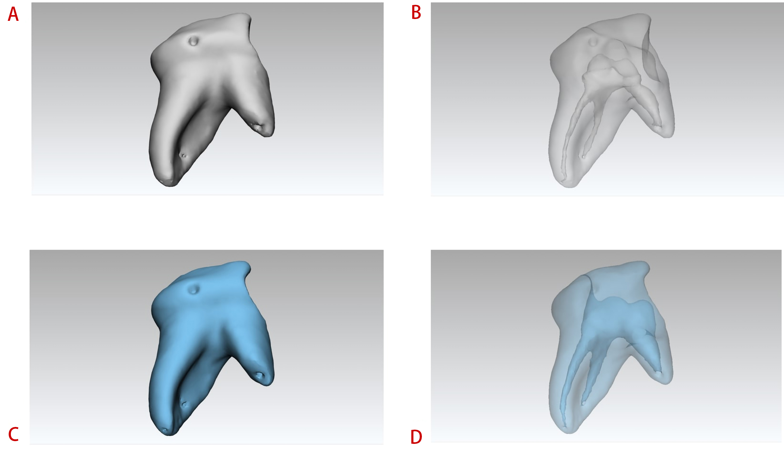 3-dimensional images demonstrating the dentine thickness and the 
structure of the internal root canals. (A) 3-dimensional image of the tooth 
before preparation; (B) 3-dimensional image of root canals before preparation; 
(C) 3-dimensional image of the tooth after preparation; (D) 3-dimensional image 
of root canals after preparation.