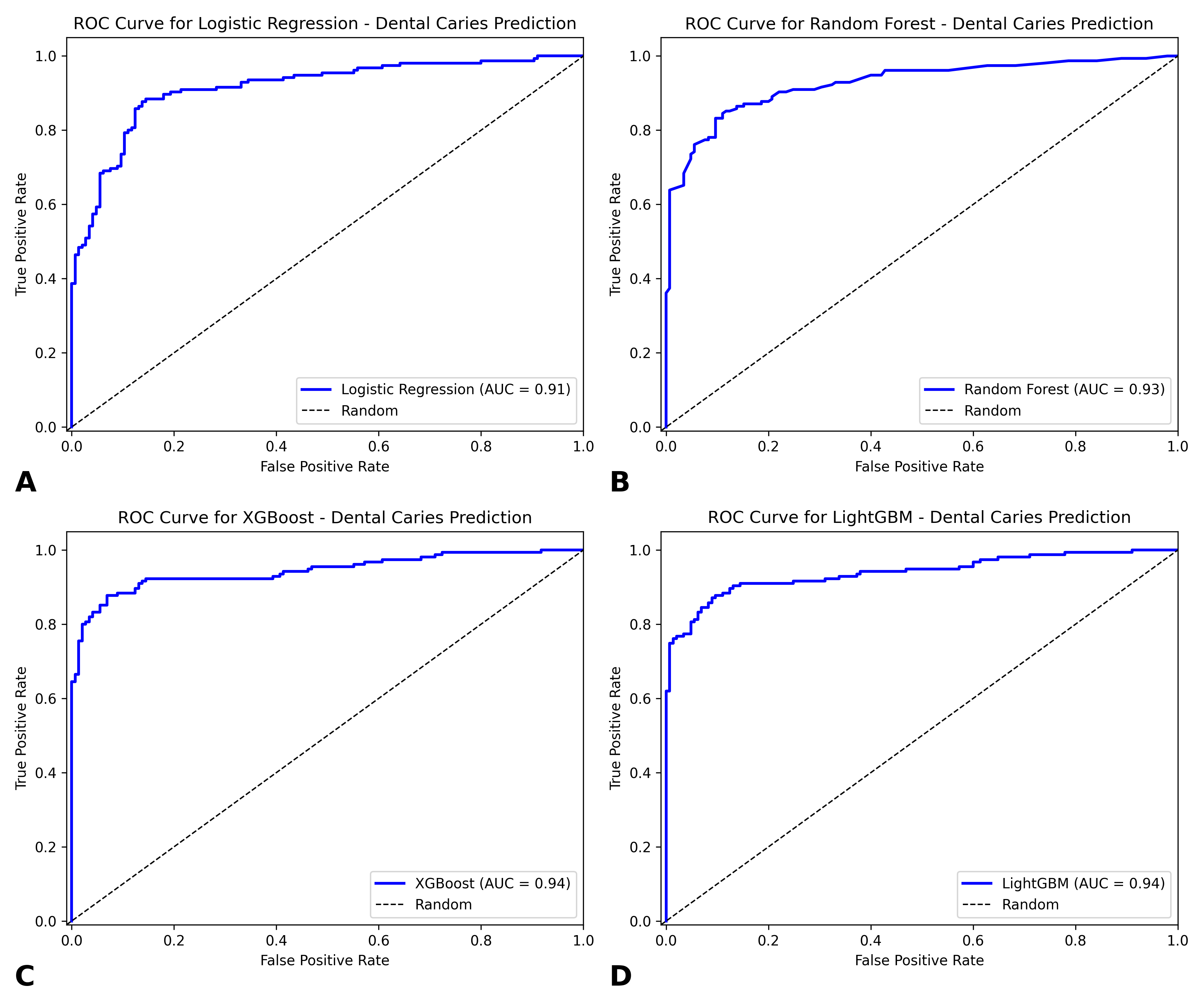Receiver Operating Characteristics Curve and Area Under the 
Curve for Dental Caries Prediction. (A) ROC Curve for Logistic Regression. (B) 
ROC Curve for Random Forest. (C) ROC Curve for XGBoost. (D) ROC Curve for Light 
GBM. ROC: Receiver Operating Characteristic; AUC: Area Under the Curve; XGBoost: 
Extreme Gradient Boosting; LightGBM: Light Gradient Boosting Machine.