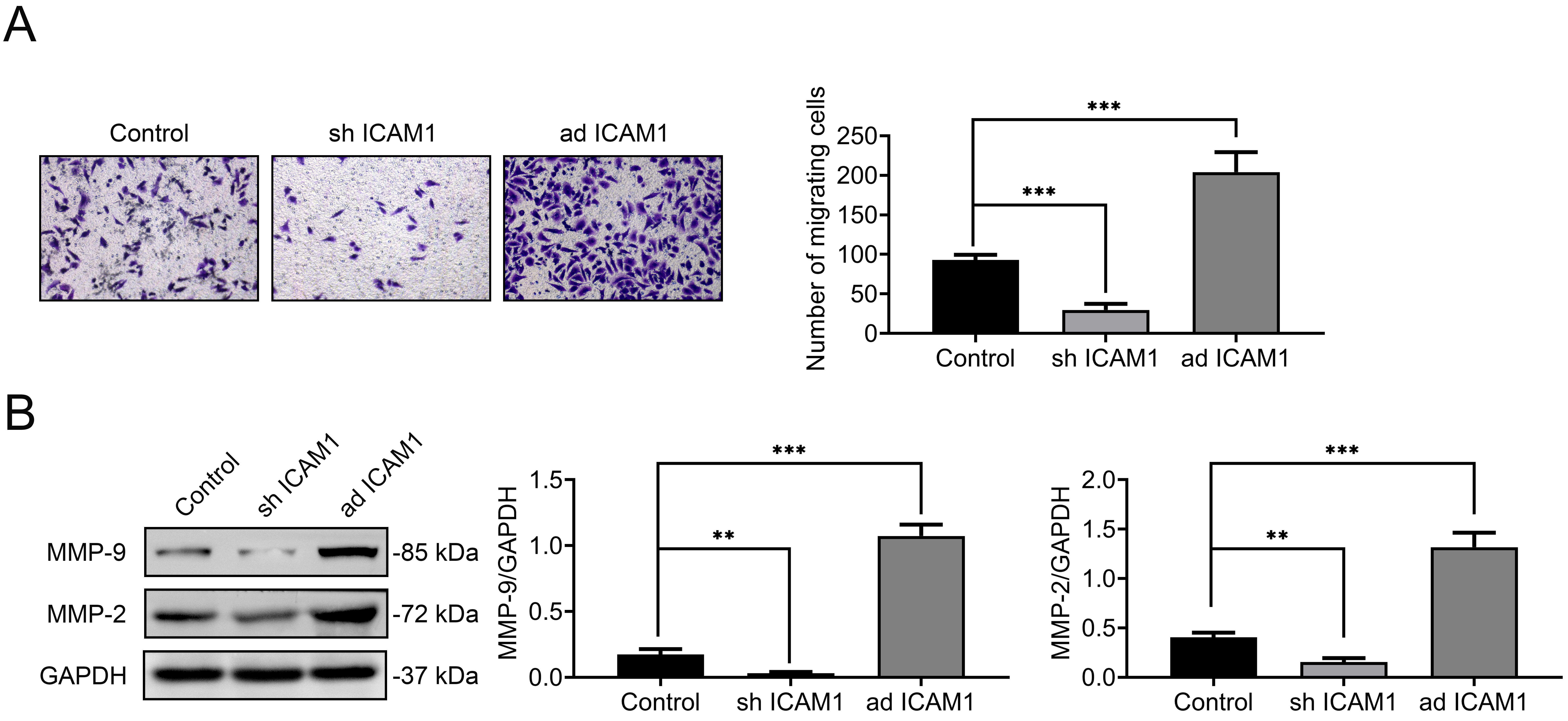 ICAM1 promotes the migration of DPSCs. (A) Transwell migration
assay quantifying migrated DPSCs in control, ad ICAM1, and sh ICAM1 groups. (B)
Western blot analysis of MMP-2 and MMP-9 expression levels in each group. Data
are presented as mean ± SD; **p < 0.01, ***p < 0.001;
technical replicates, n = 3. ICAM1: intercellular adhesion molecule 1; MMP:
Matrix Metalloproteinase; GAPHD: Glyceraldehyde-3-Phosphate Dehydrogenase.