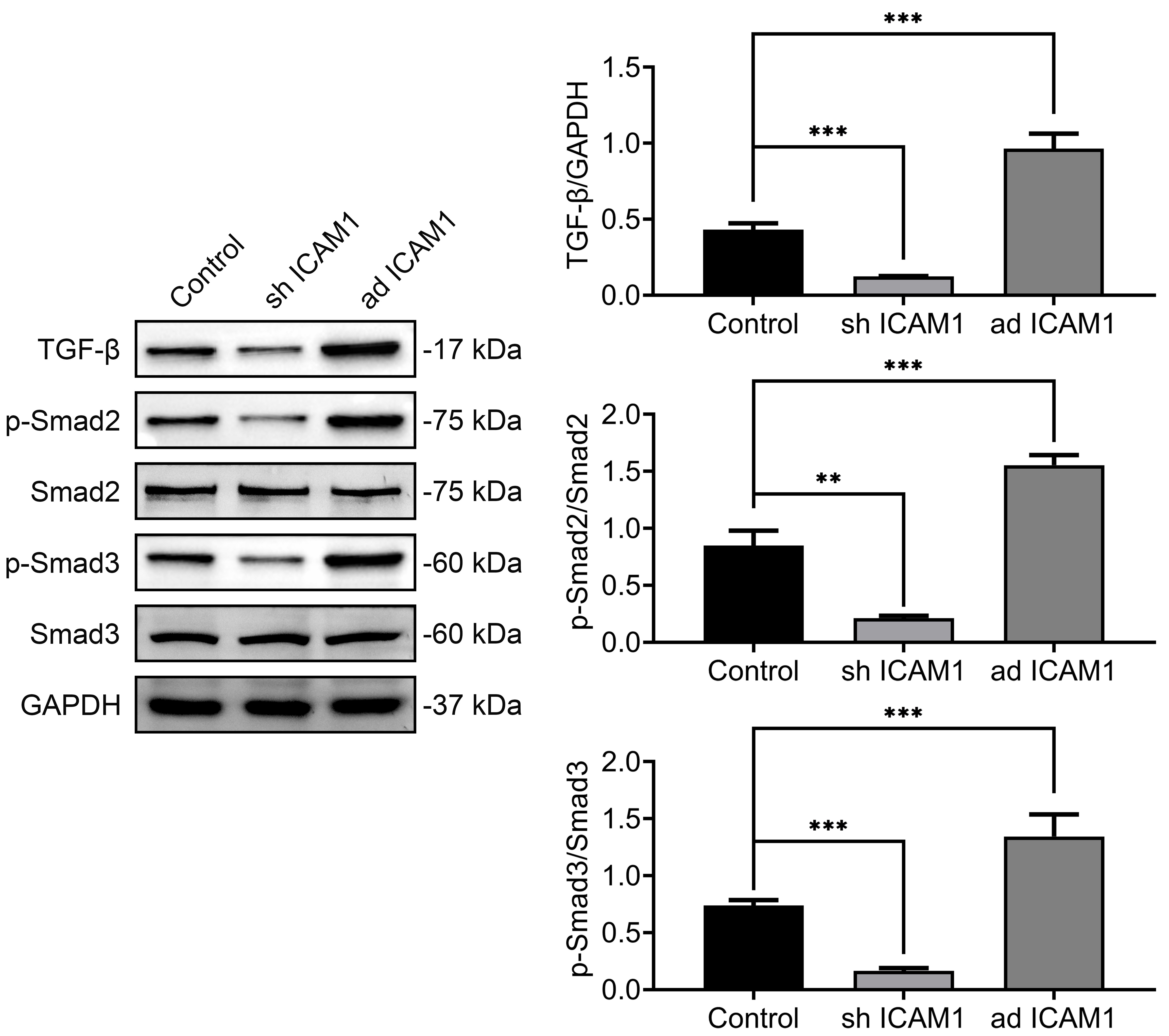 ICAM1 activates the TGF-β1/Smad signaling pathway. Western blot analysis showing expression levels of TGF-β1, total and
phosphorylated Smad2 and Smad3 in DPSCs following ICAM1 modulation. Data are
presented as mean ± SD; **p < 0.01, ***p < 0.001;
technical replicates, n = 3. ICAM1: intercellular adhesion molecule 1; TGF:
transforming growth factor; Smad: Mothers
Against Decapentaplegic Homolog; GAPHD: Glyceraldehyde-3-Phosphate Dehydrogenase.