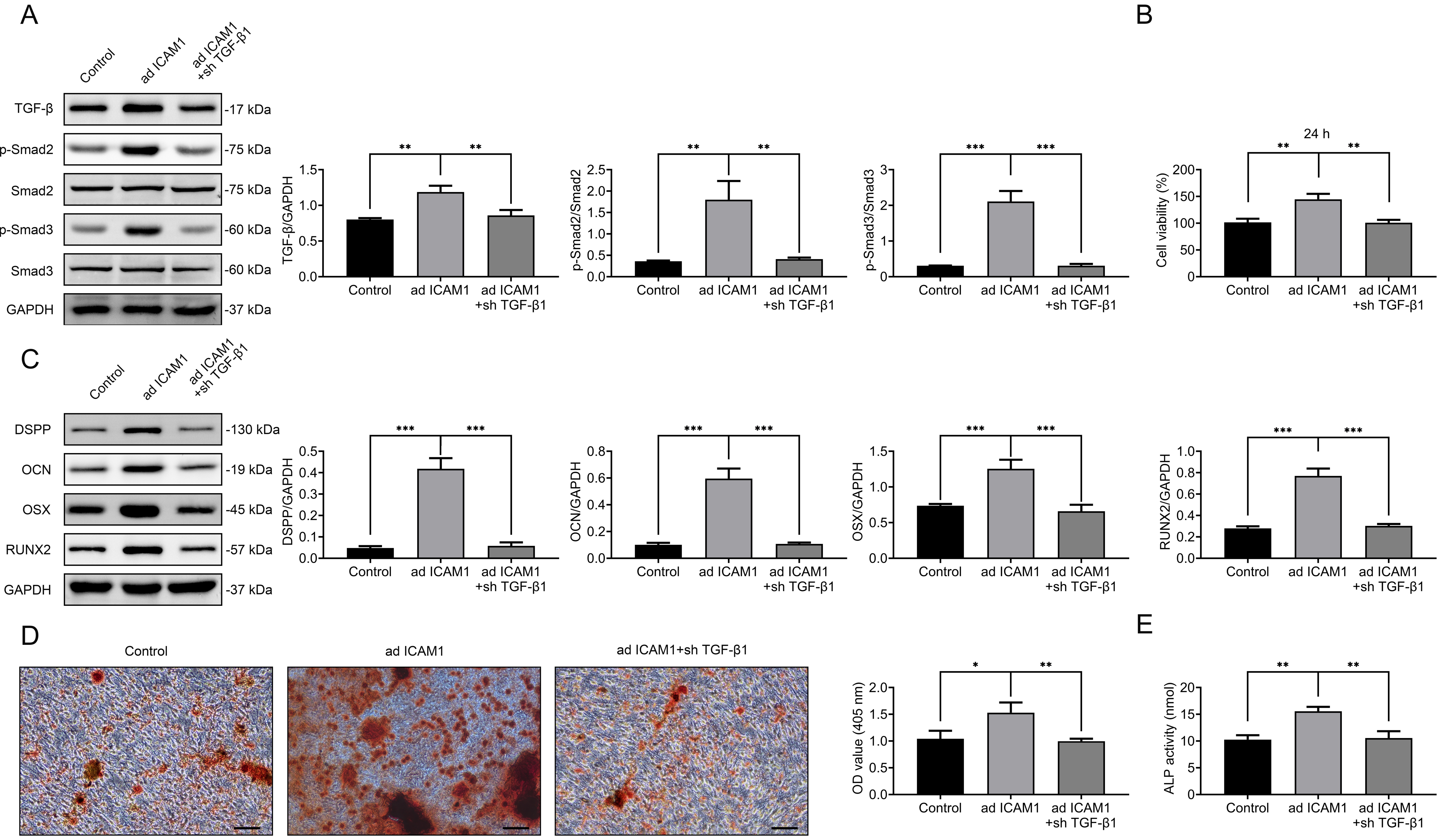 Knockdown of TGF-β1 reverses the ICAM1-induced
enhancement of odontoblast differentiation. (A) Western blot analysis of
TGF-β1, Smad2, p-Smad2, Smad3, and p-Smad3 following TGF-β1
knockdown in ad ICAM1-expressing DPSCs. (B) CCK-8 assay assessing cell viability.
(C) Western blot analysis of DSPP, OCN, RUNX2, and OSX expression. (D) Alizarin
Red S staining of mineralized matrix. (E) ALP activity assay. Data are presented
as mean ± SD; *p < 0.05, **p < 0.01, ***p
< 0.001; technical replicates, n = 3. ICAM1: intercellular adhesion molecule 1;
TGF: transforming growth factor; DSPP: dentin sialophosphoprotein; OCN:
osteocalcin; RUNX2: runt-related transcription factor 2; OSX: osterix; Smad:
Mothers Against Decapentaplegic Homolog; GAPHD: Glyceraldehyde-3-Phosphate
Dehydrogenase; OD: Optical Density; ALP: Alkaline Phosphatase.