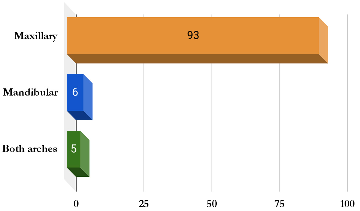 Distribution of canine impaction by arch.