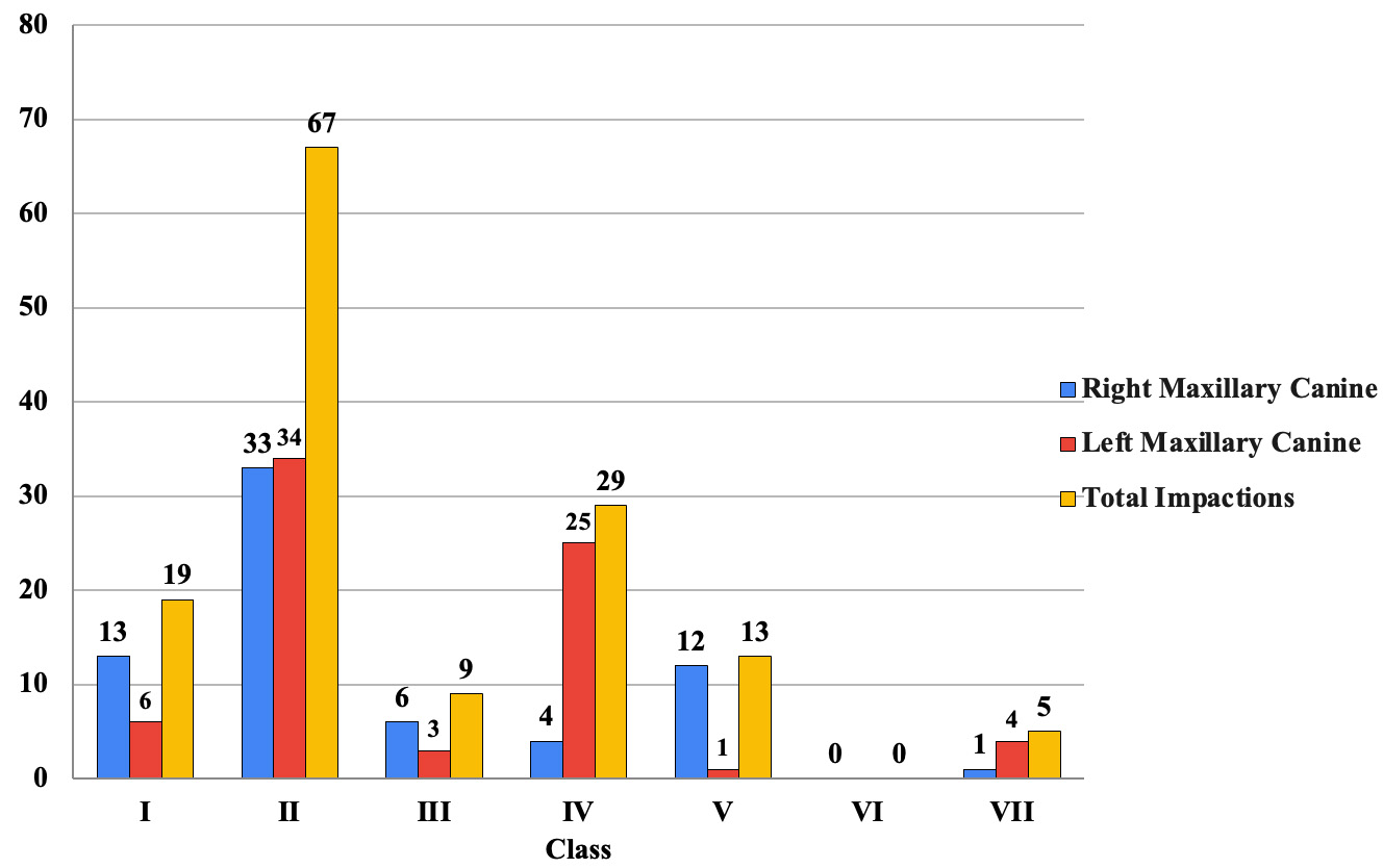 Impacted canine distribution according to Yamamoto et 
al. [14] classifications.