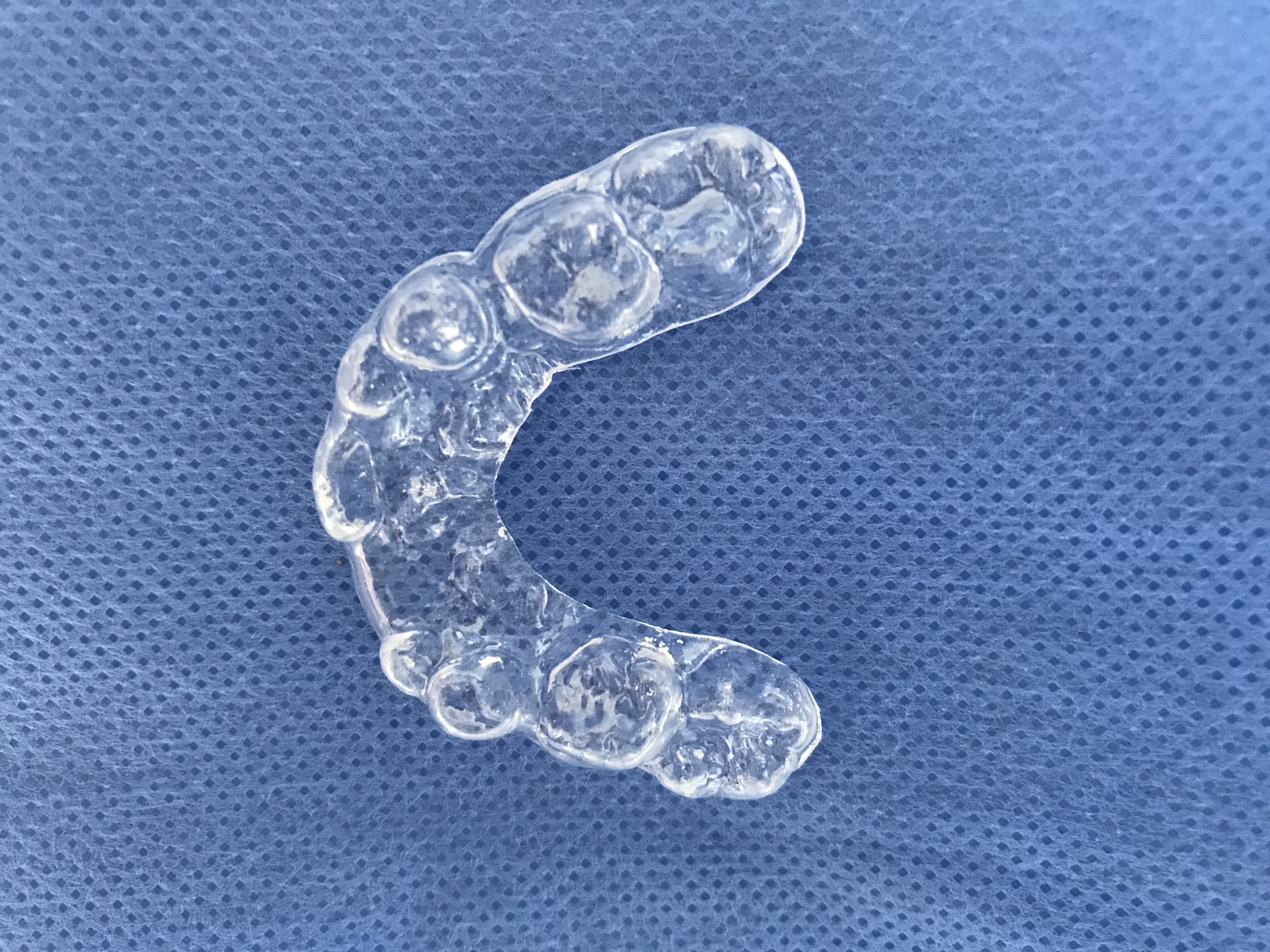 Occlusal splint in a child.