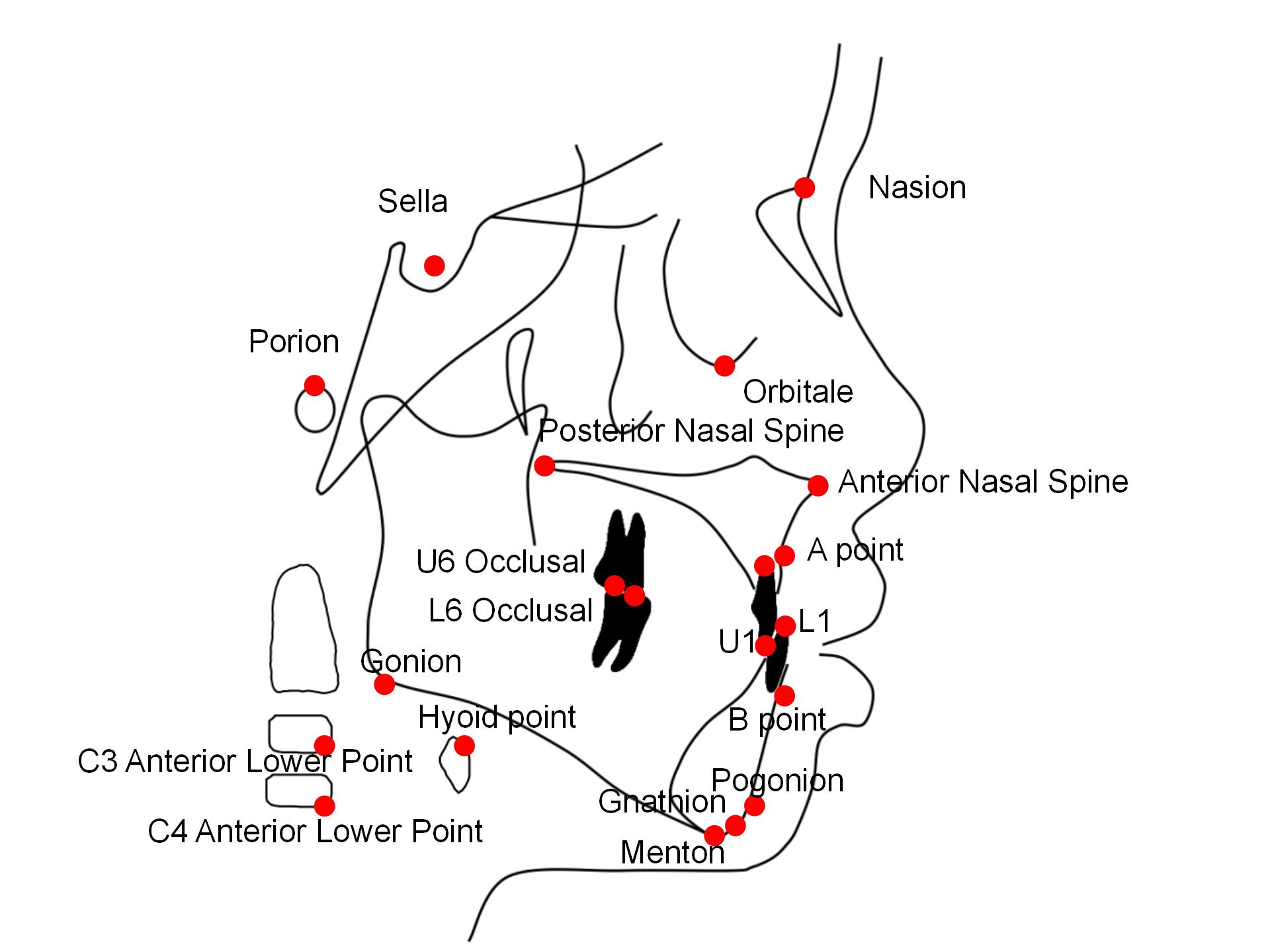 The cephalometric landmarks used in this study.