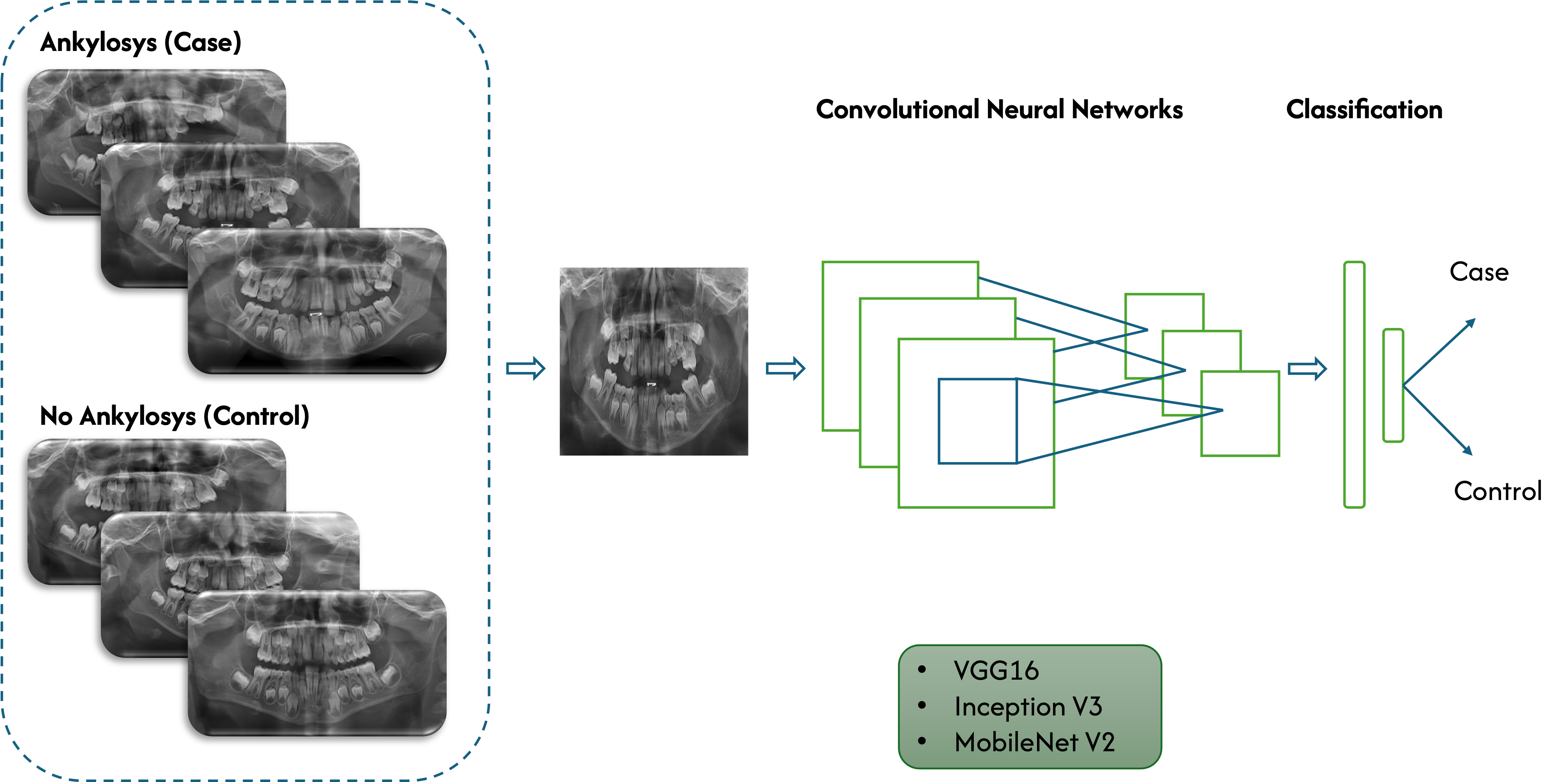 Decision flow of the system (the
relevant figure illustrates the overall workflow of the study methodology). VGG16: Visual Geometry Group 16-layer.
