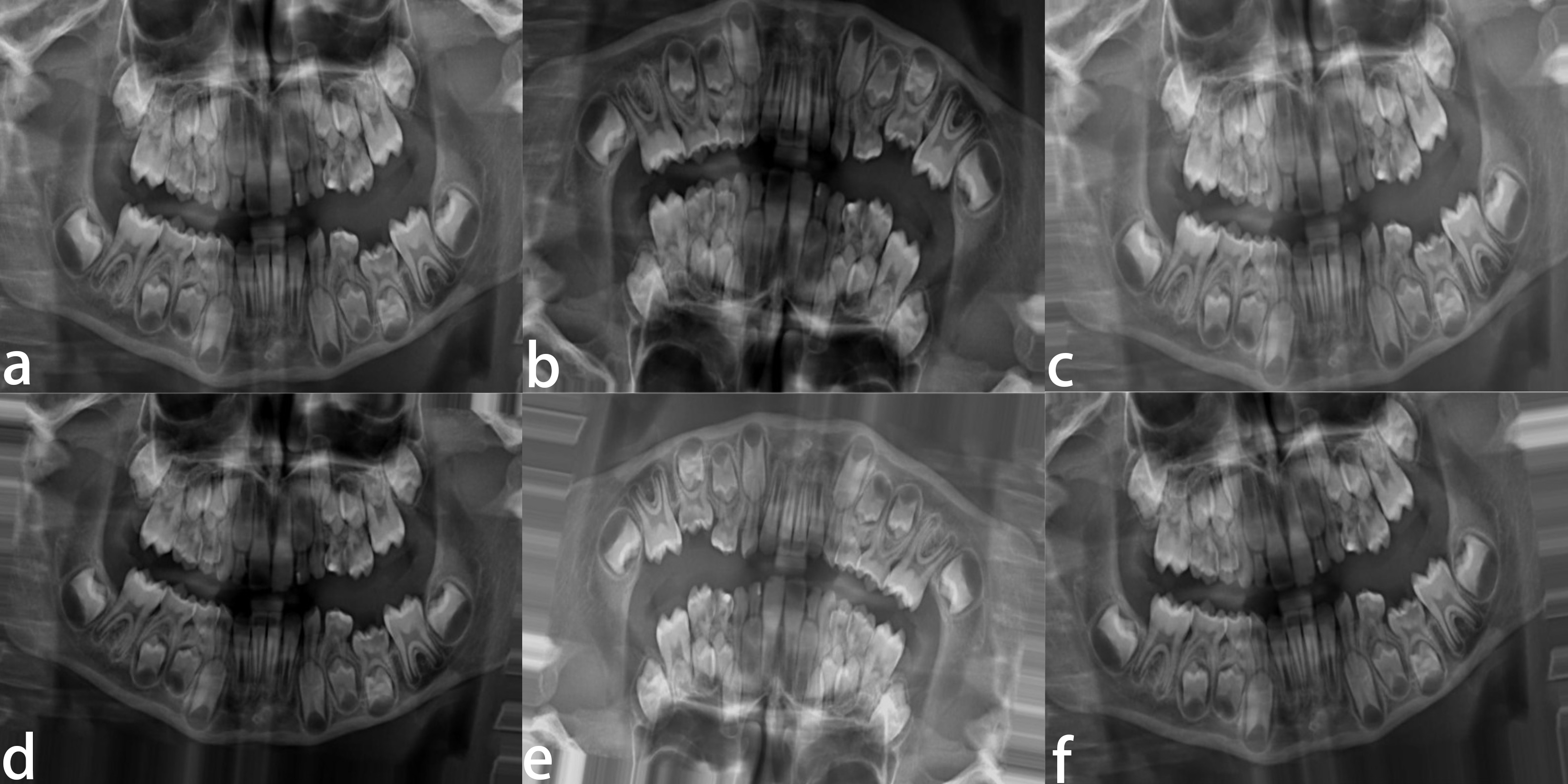 Examples of images generated randomly for data purposes. (a)
Randomly generated image examples for data augmentation copy not augmented. (b)
Randomly generated image examples for data augmentation copy vertical flipped and
rotated. (c) Randomly generated image examples for data augmentation copy channel
shifted and rotated. (d) Randomly generated image examples for data augmentation
copy vertical shifted and rotated. (e) Randomly generated image examples for data
augmentation vertically flipped and channel shifted, and rotated. (f) Randomly
generated image examples for data augmentation vertically shifted and rotated.