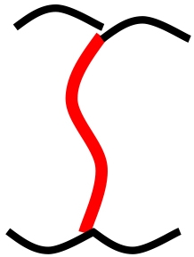 S type: curved straight contact (>1.5 mm) between primary molars