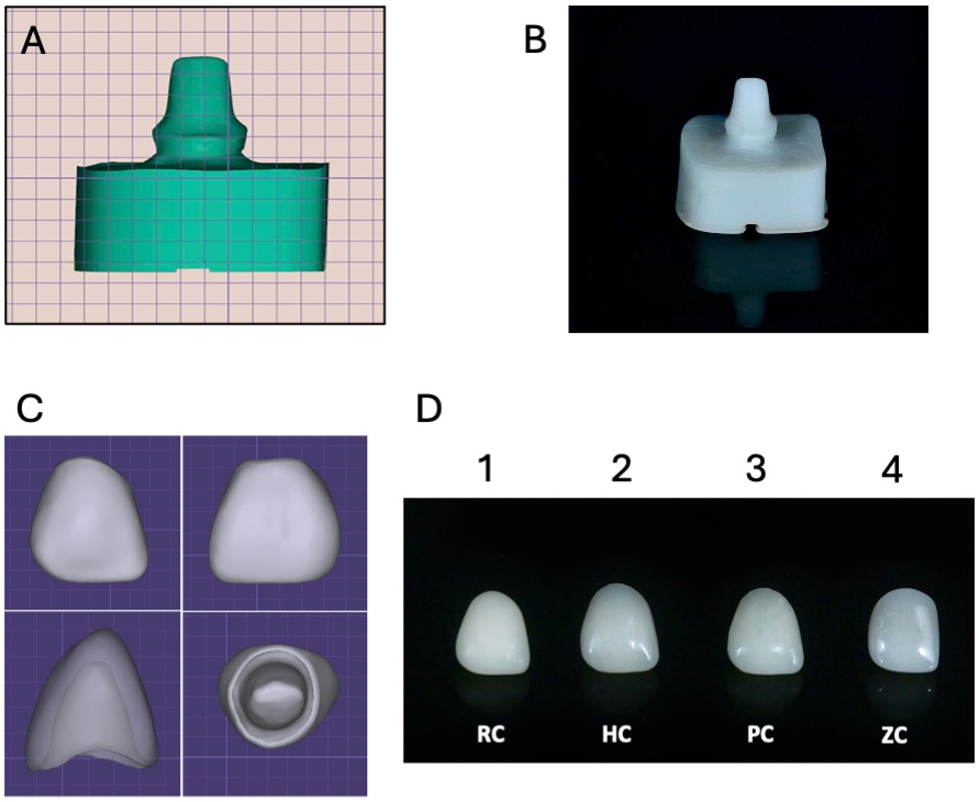 Core design and manufacturing. (A) 3D core design. (B) 3D 
printed cores. (C) 3D-designed crown. (D) Manufactured crowns, including (1) 
3D-printed resin (RC); (2) milled hybrid ceramic (HC), (3) milled PMMA (PC) 
and (4) prefabricated zirconia crowns (ZC).
