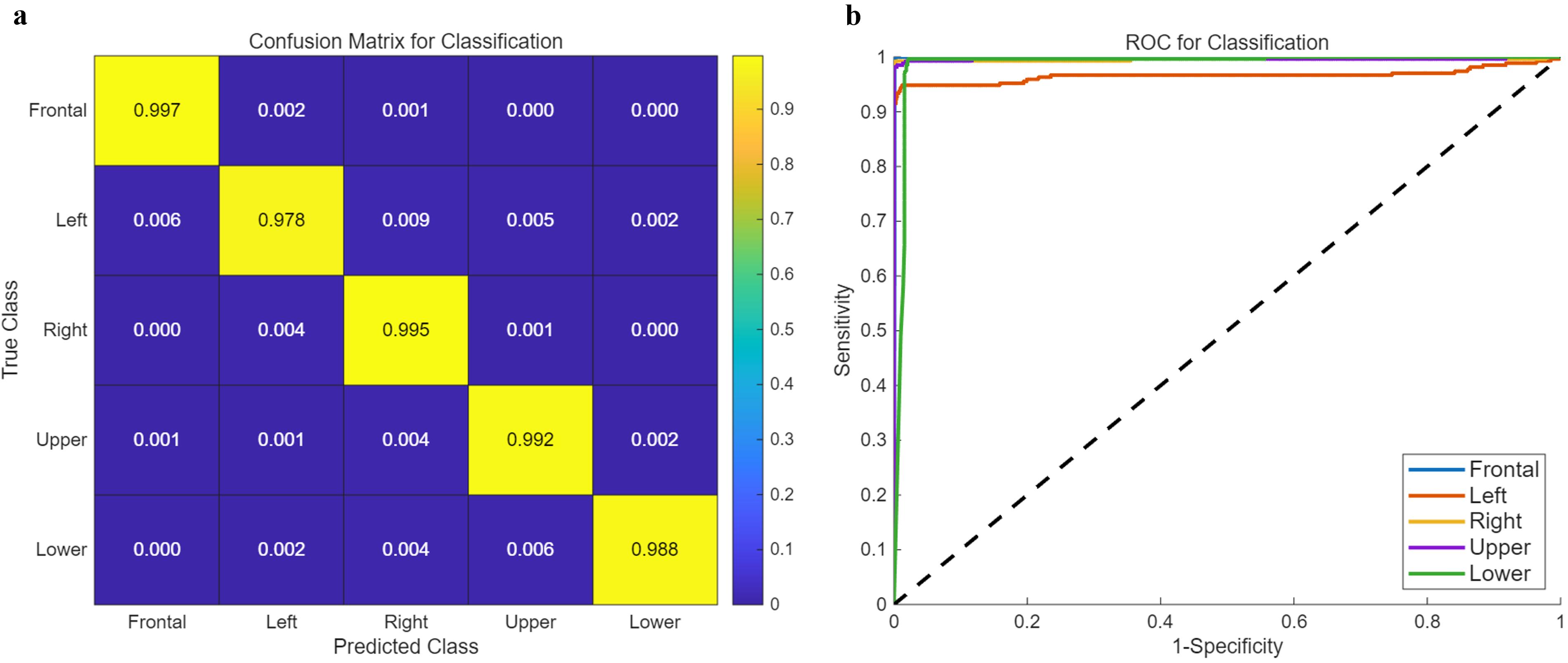 Classification performance of the Inception-ResNet-v2 model for
intraoral image classification. (a) Confusion matrix. (b) ROC curve. ROC:
Receiver operating characteristic.