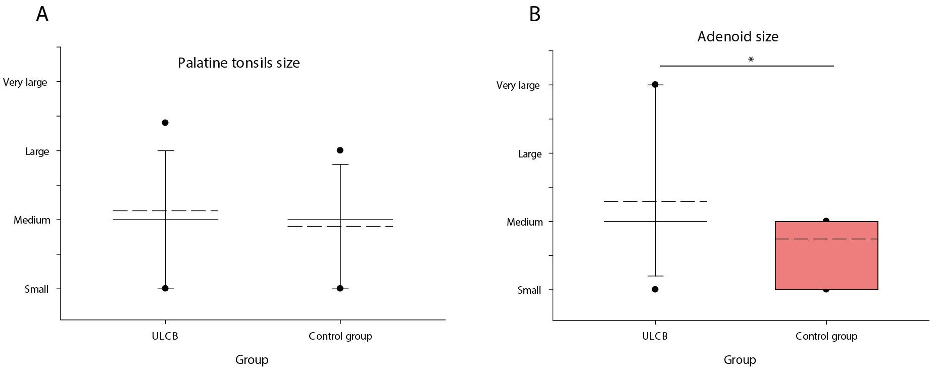 Palatine tonsil (A) and adenoid size (B) in
experimental and control group at the baseline. ULCB: Unilateral posterior
crossbite. An asterisk (*) signifies a p-value ≤ 0.05.