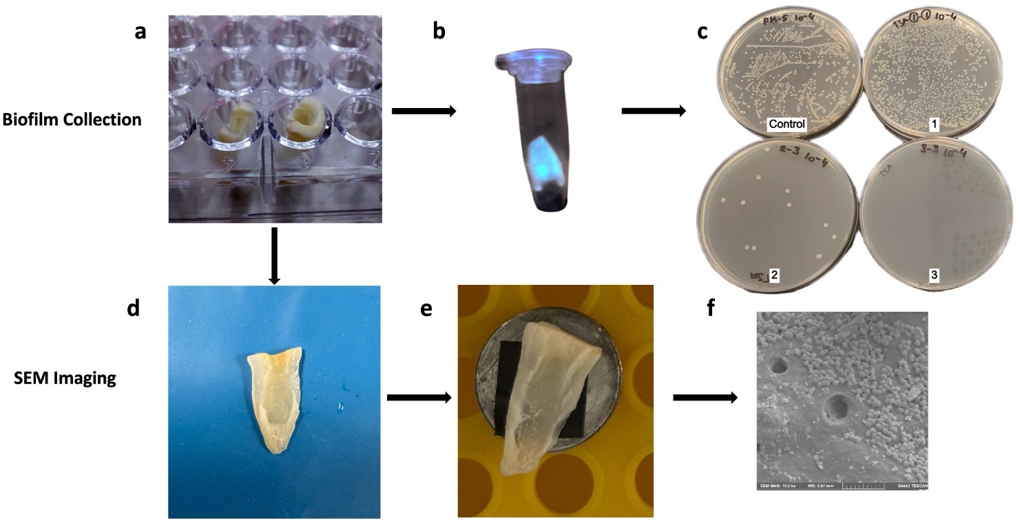 The experimental flow chart of the study. (a) the root in the
plate, (b) the root in the Eppendorf tube before centrifuging, (c) Bacterial
culture plates from Groups I, II, III, and the control group following the
interventions, (d) the half of the root after seperation, (e) the sample on the
aluminum stub, (f) The obteined SEM image. SEM: scanning electron microscope.