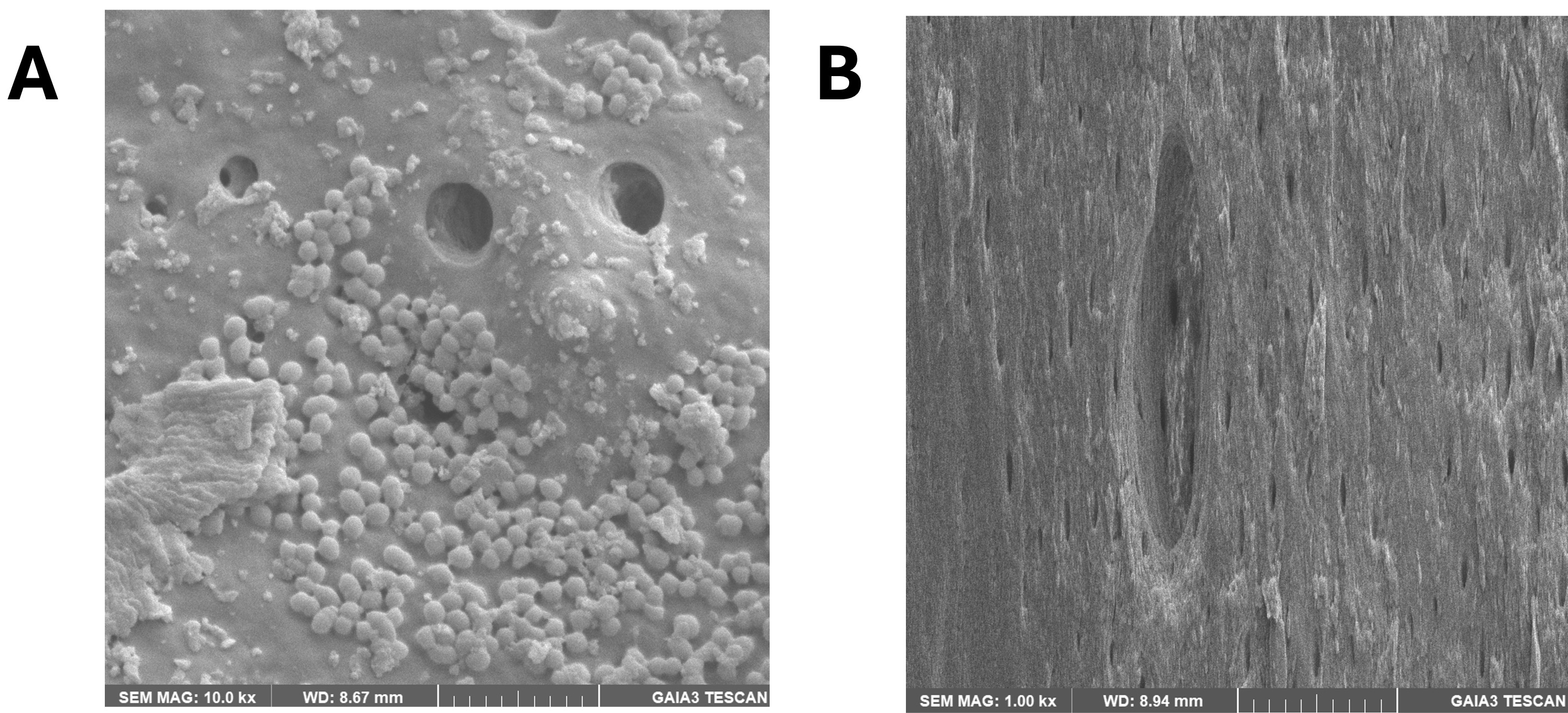 SEM images of the control groups: (A) positive control at 10.0
kx and (B) negative control at 1.00 kx magnification. (A) The dentin surface
exhibits multiple open tubules surrounded by abundant spherical,
microorganism-like particles and amorphous debris, consistent with bacterial
biofilm presence. (B) The dentin surface shows clean tubule morphology with no
observable microbial aggregates, debris, or biofilm-related structures.