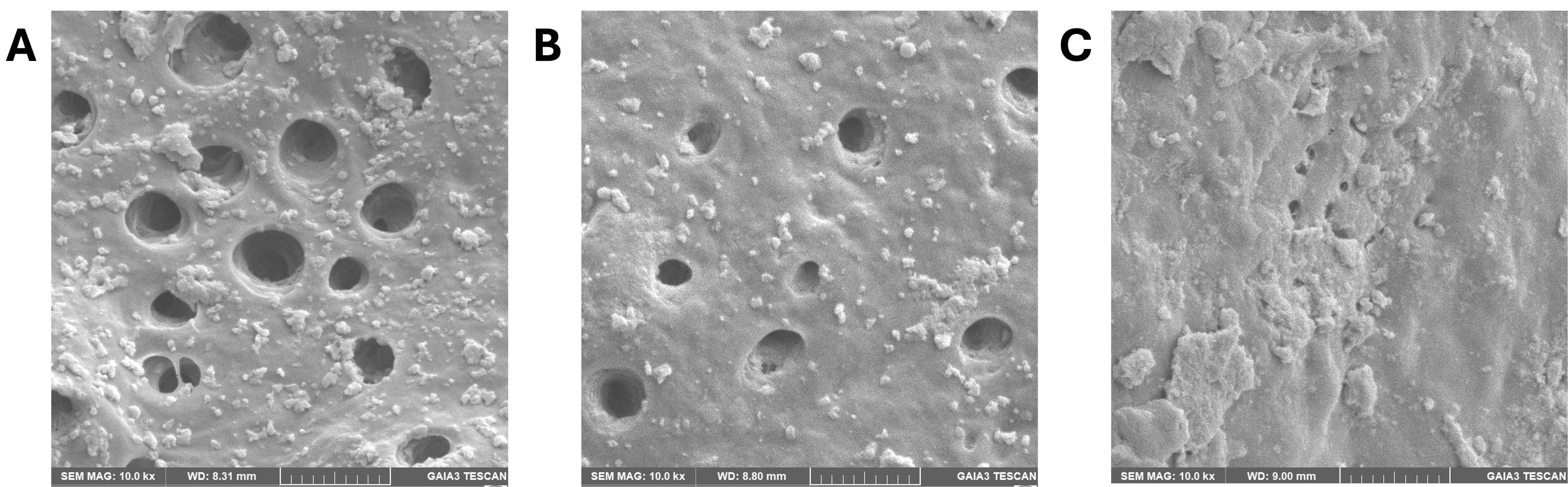 SEM images of (A) Group 1 (NIET), (B) Group 2 (ProTaper
Ultimate), and (C) Group 3 (Pro AF Baby Gold) under 10.0 kx magnification.
Dentin tubules appear as round openings on the dentin surface. The amorphous,
granular, and irregular structures observed around the tubule orifices and across
the surface represent components of the bacterial biofilm, including
extracellular polymeric substances (EPS) and microorganism-like particles. These
biofilm-associated formations appear as uneven layers, clustered particulate
accumulations, or dense deposits partially occupying the tubule openings. In some
regions, organic–inorganic debris, bacterial aggregates, and matrix-like
structures are evident, reflecting the morphological characteristics of microbial
colonization.