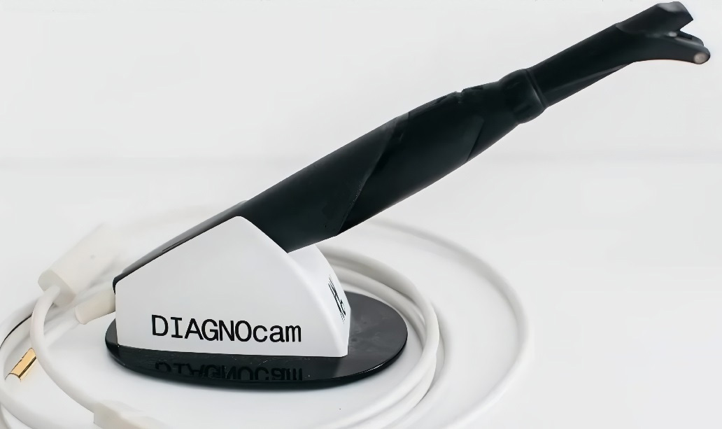 The DIAGNOcam device (KaVo, Germany) prepared for examination with the
handpiece and tip attached (photo by authors).
