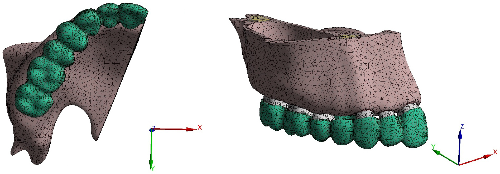Coordinate axis position of the model. This model’s mesh
element type was 3D 10-node tetrahedrons. This figure showed the
three-dimensional coordinate axis positions and the displacement tendencies
within the model.