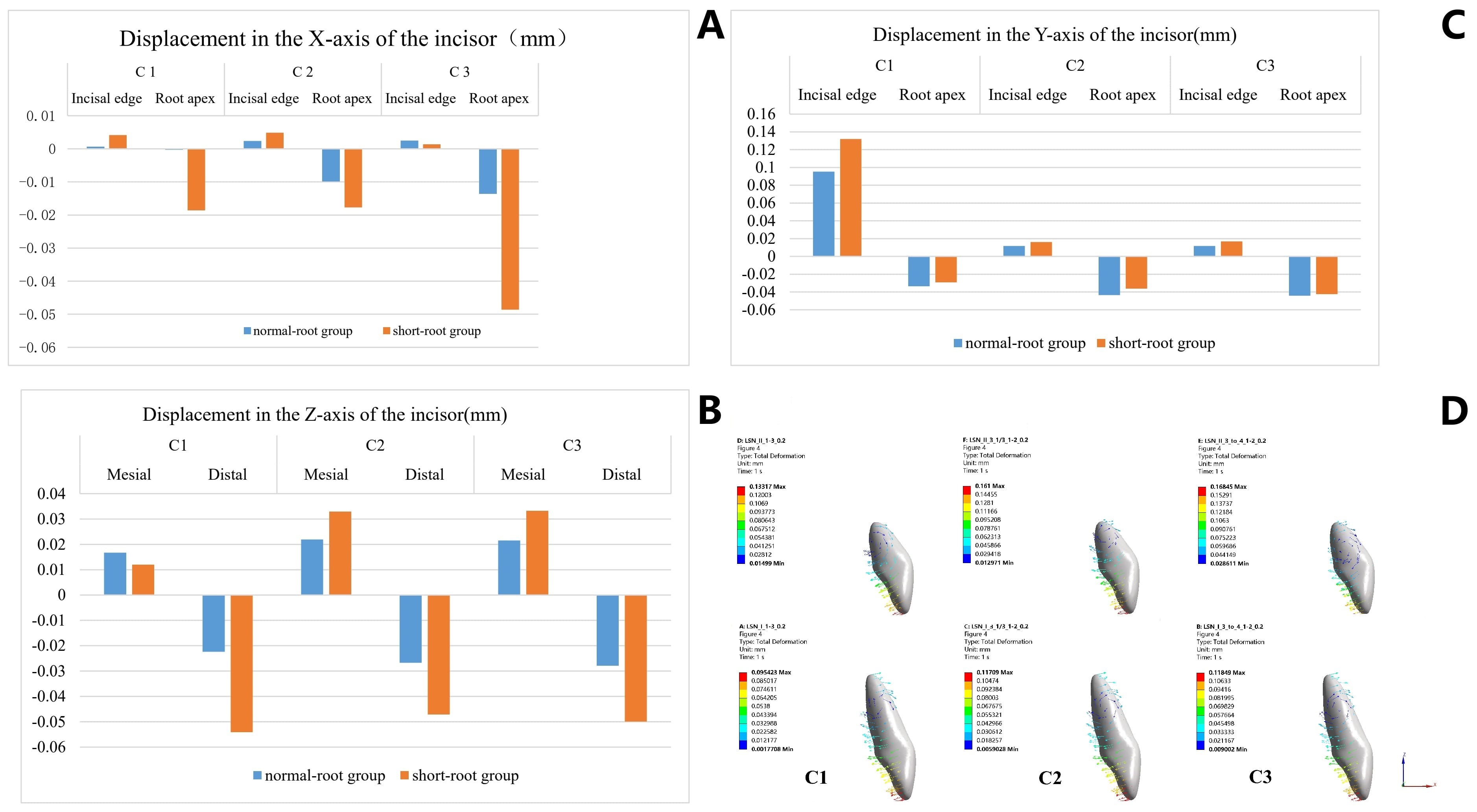 Movement of the upper central incisor. (A) The displacement
along the X-axis was maximum in C3. (B) The displacement along the Z-axis was
minimal in C1. (C) The greatest retraction occurred along the Y-axis under C1.
(D) Histograms showing the 3D displacement (in mm) of the central incisor along
the X-, Y-, and Z-axes under each movement condition. Max: maximum; Min: minimum.