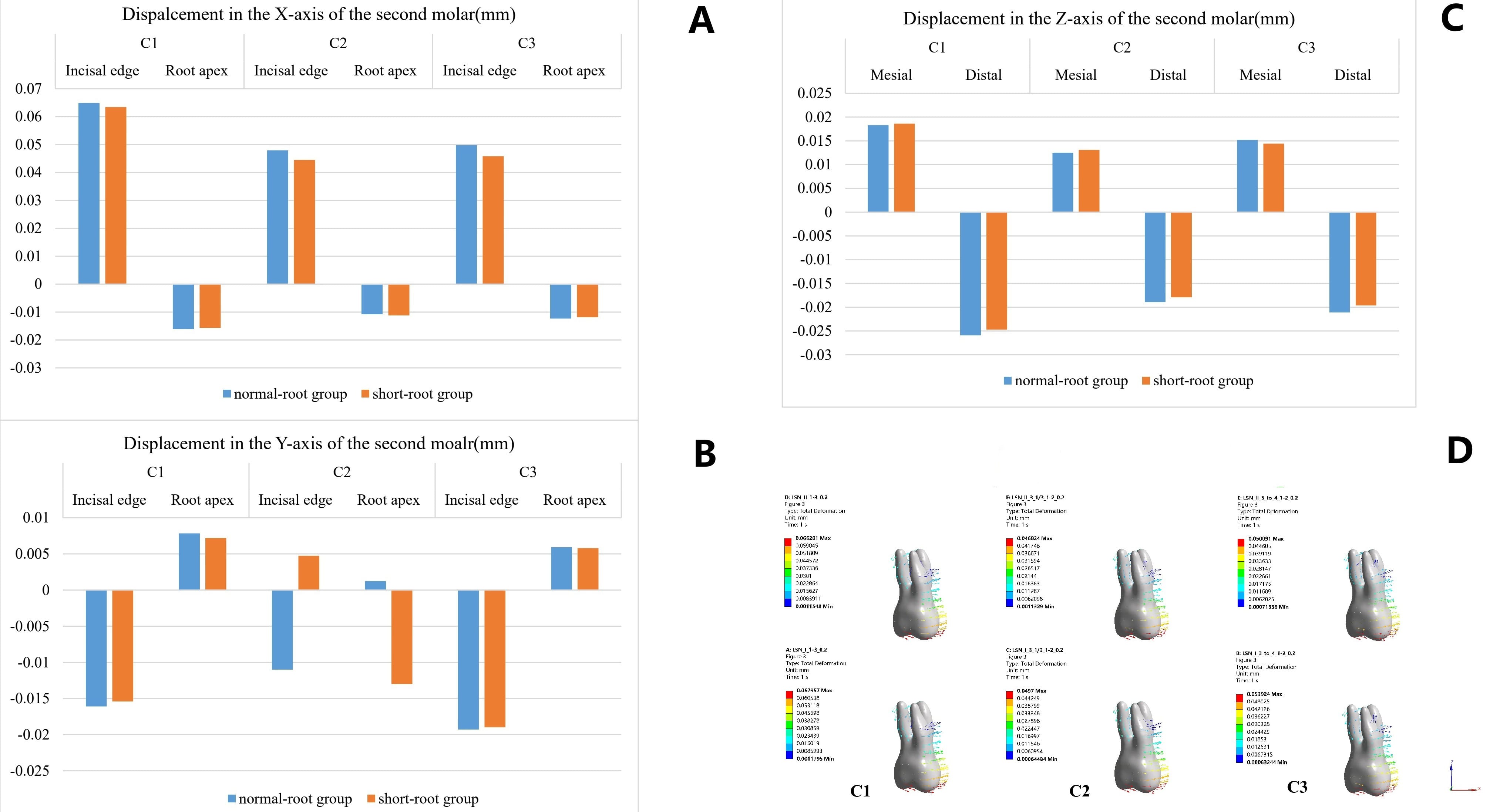 Movement of the second molar. (A,C) The greatest displacement
occurred along the X-axis and Z-axis under C1. (B) Along the Y-axis, it
demonstrated a pattern of buccal inclination. (D) Histograms showed the 3D
displacement of the second molar. Max: maximum; Min: minimum.