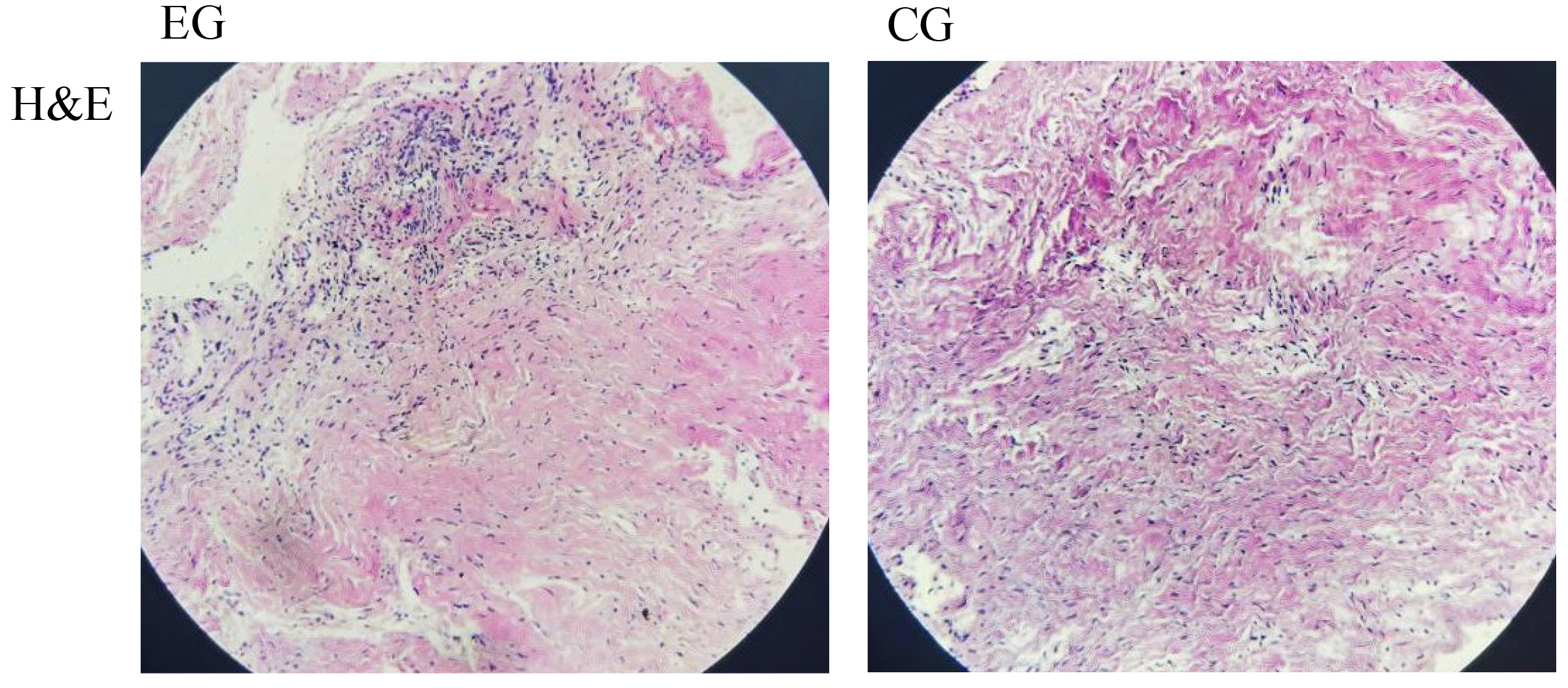 Hematoxylin and eosin (H&E)
staining showed dental follicle cell volume in the eruption
disturbance group (Group EG) was decreased and their nuclei were condensed
compared to the control group (Group CG) (×400).