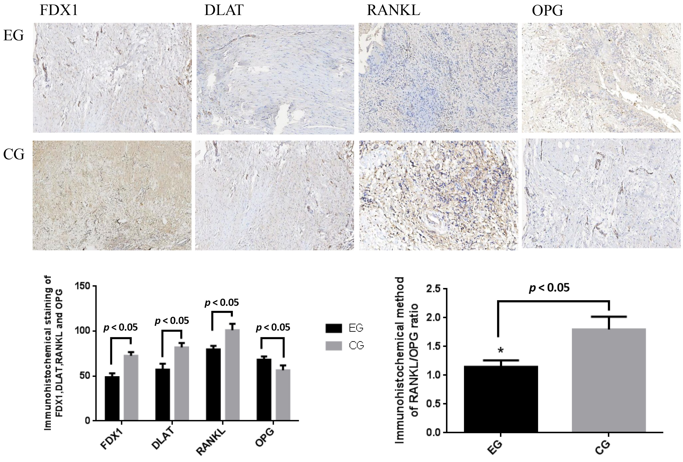 Immunohistochemical (IHC) staining results of the dental
follicle tissue showed reduced expression of ferredoxin1 (FDX1), dihydrolipoamide
S-acetyltransferase (DLAT), and receptor activator of nuclear factor κB
ligand (RANKL) proteins in the eruption disturbances group (Group EG), while
osteoprotegerin (OPG) expression was increased (×400). Statistical
analysis confirmed that FDX1, DLAT, and RANKL expression levels, as well as the
RANKL/OPG ratio, were lower in Group EG, whereas OPG expression was higher
compared with Group CG (*p < 0.05). CG: control group.