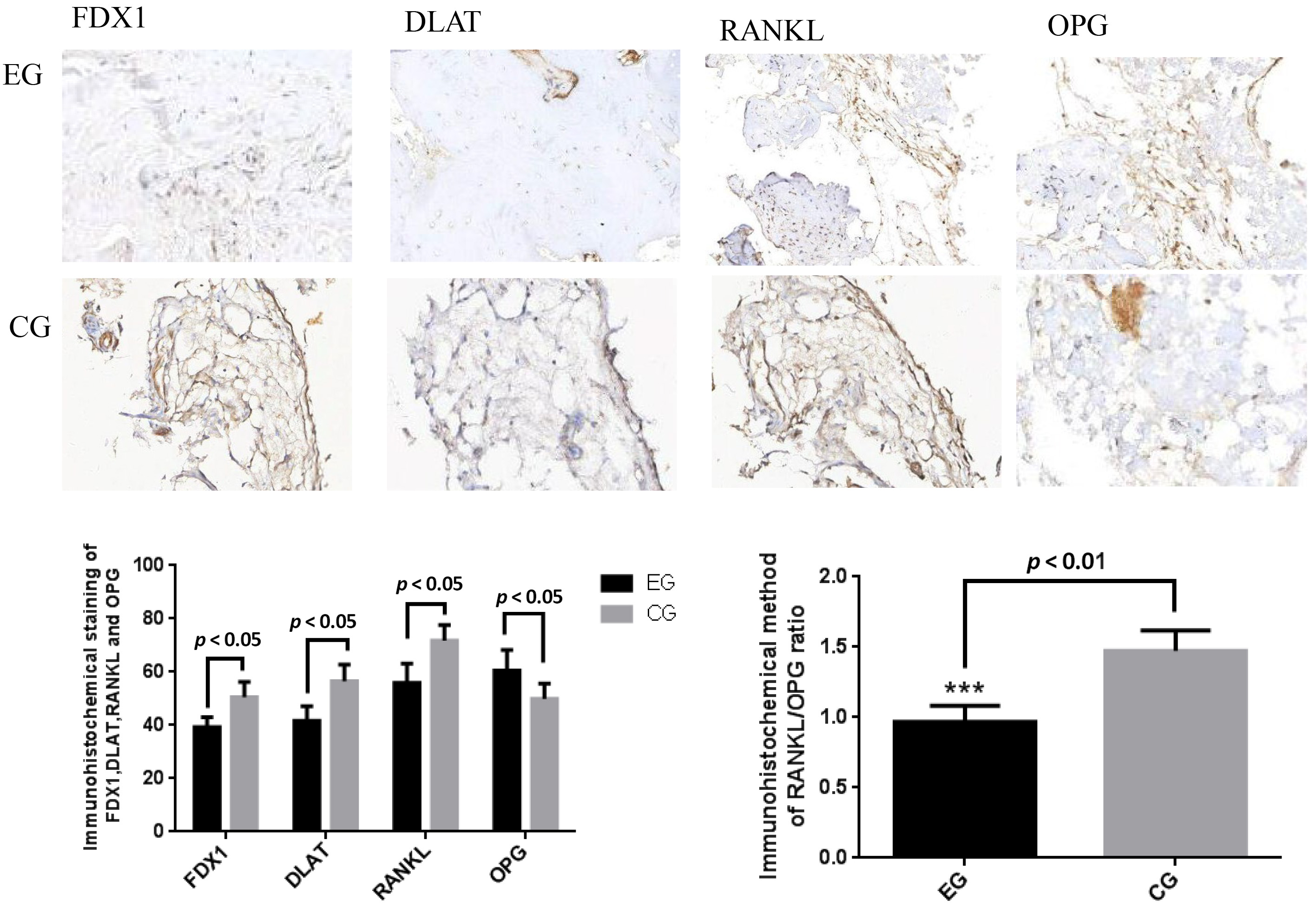 Immunohistochemical (IHC) staining of the alveolar bone tissue
showed decreased expression of ferredoxin1 (FDX1), dihydrolipoamide
S-acetyltransferase (DLAT), and receptor activator of nuclear factor κB
ligand (RANKL) proteins in the eruption disturbance group (Group EG), with
increased osteoprotegerin (OPG) expression (×400). Statistical analysis
revealed that the FDX1, DLAT, and RANKL expression levels, and the RANKL/OPG
ratio, were significantly lower in Group EG, whereas OPG expression was
significantly higher compared with Group CG (p < 0.05,
***p < 0.01). CG: control group.