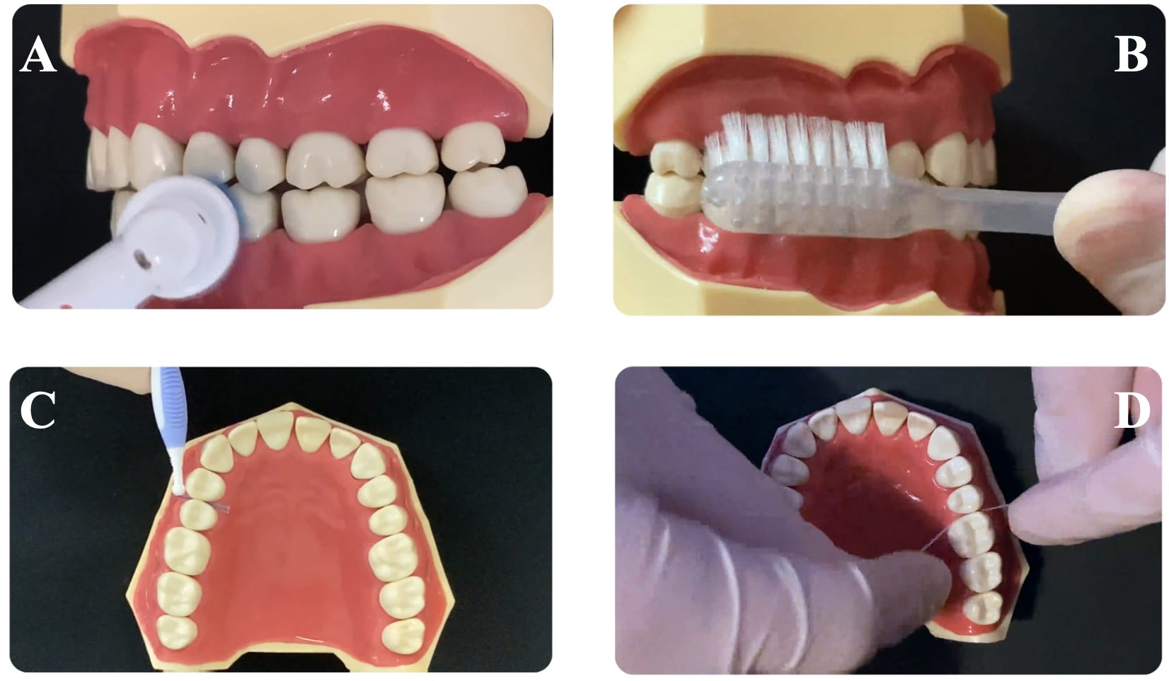 Frames from videos regarding daily oral hygiene techniques. (A)
electric toothbrush, (B) manual toothbrush, (C) interdental brush, and (D) dental
floss.
