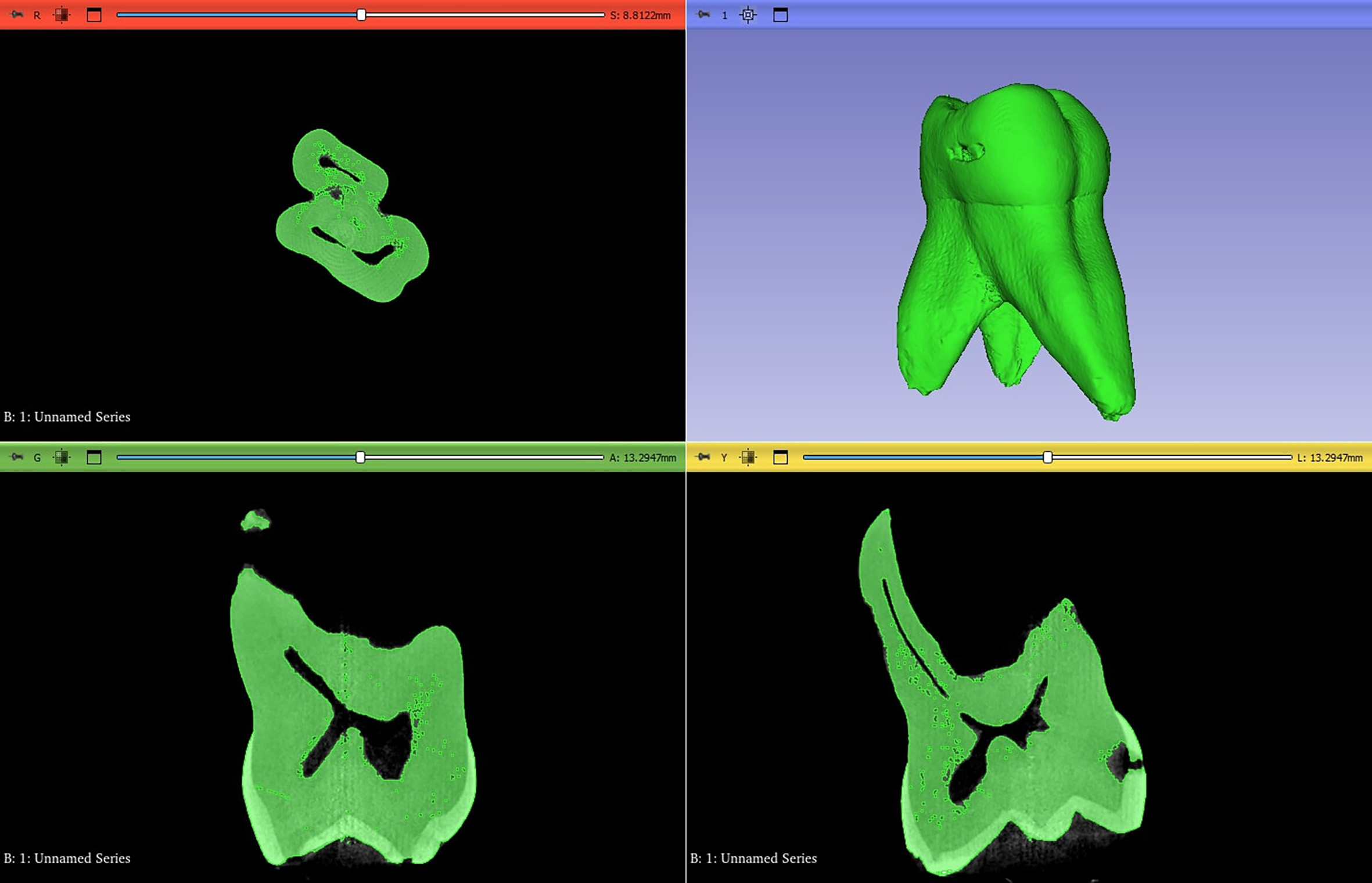 Visualization of the tomography data obtained after 
reconstruction.
