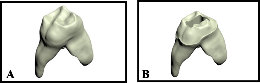 Dentin structure in healthy and crown-prepared tooth models. (A) 
Dentin structure in the healthy tooth model. (B) Dentin structure in the 
crown-prepared tooth model.