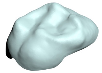 3D modeling of glass ionomer cement and resin-modified glass 
ionomer cement to be used when bonding the crown material.
