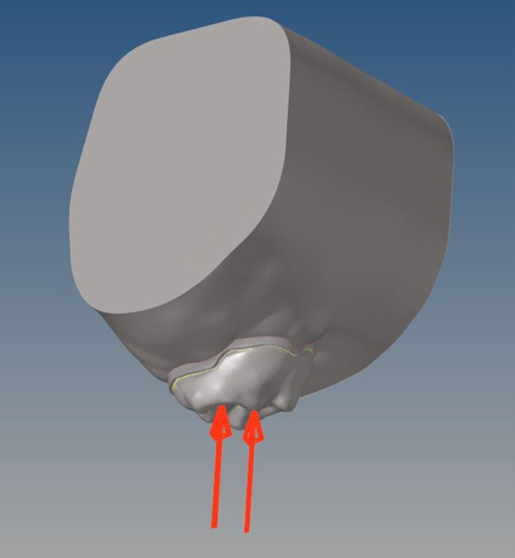 Location and direction of force application. Application of a 
total vertical force of 245 N at a 0° angle from the central fossa.