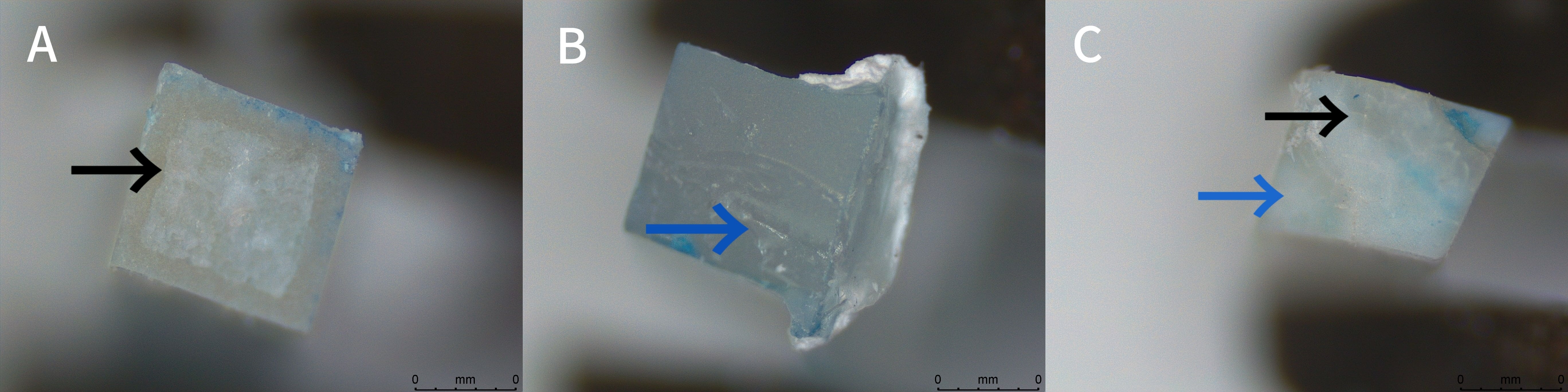 Images (A), (B) and (C) show Type I (Adhesive), Type II (cohesion) and 
Type III (mixed) fractures, respectively. The black arrows indicate bonding 
interface fracture; and the blue arrows indicate intra-resin fracture.