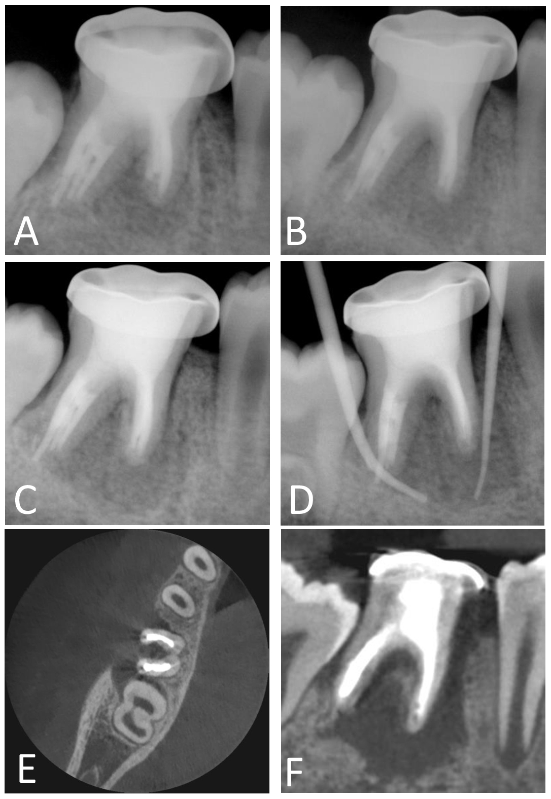 Journal of Clinical Pediatric Dentistry (JOCPD)