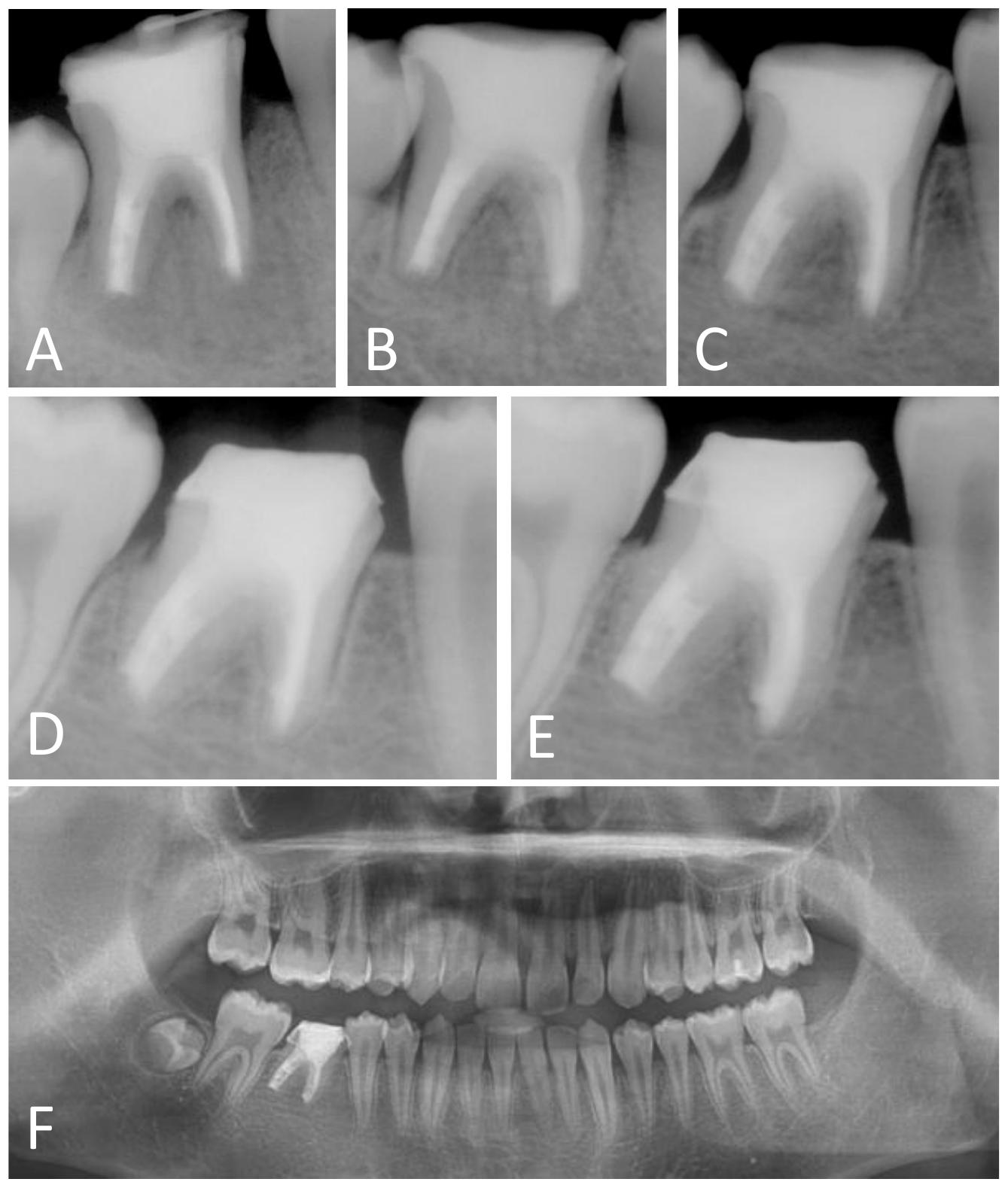 Journal of Clinical Pediatric Dentistry (JOCPD)