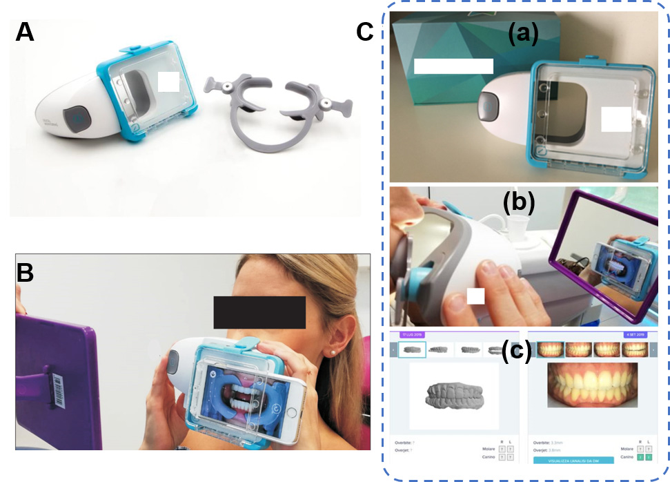 Display and software interface of DM. (A) Dental 
monitoring® (DM) ScanBox© and cheek retractor 
(From Caruso et al. [101], 2021, licensed under CC BY 4.0.). (B) 
ScanBox© for remote monitoring by Dental 
Monitoring® (From Sangalli et al. [103], 2022, licensed 
under CC BY 4.0.). (C) Scanbox© for remote 2D photo monitoring by 
Dental Monitoring® (a), device used by the patient (b), and 
software interface (c) (From Sangalli et al. [102], 2021, licensed under 
CC BY 4.0.).