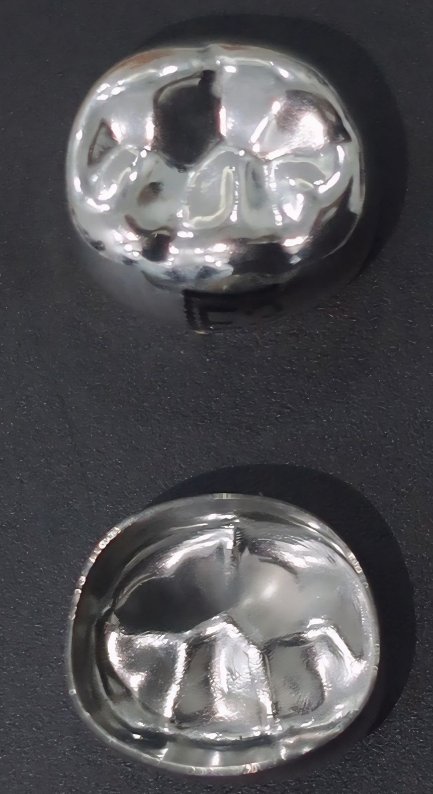 Stainless-steel crowns (Kids Crown; Shinhung, Seoul, Korea).