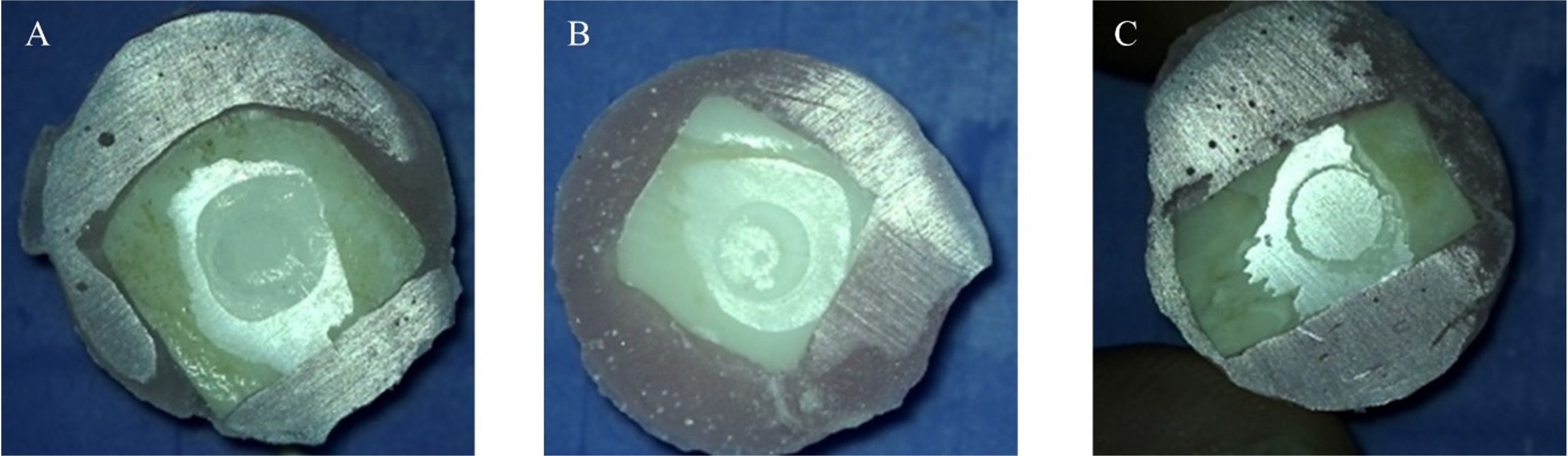 Representative images of bonding failure modes captured with a
Zeiss OPMI Pico S100 microscope at magnification of 25×. (A) Cohesive
failure (>80% of remaining sealant); (B) Mixed failure (20–80% of the
remaining sealant); and (C) Adhesive Failure (<20% of remaining sealant).