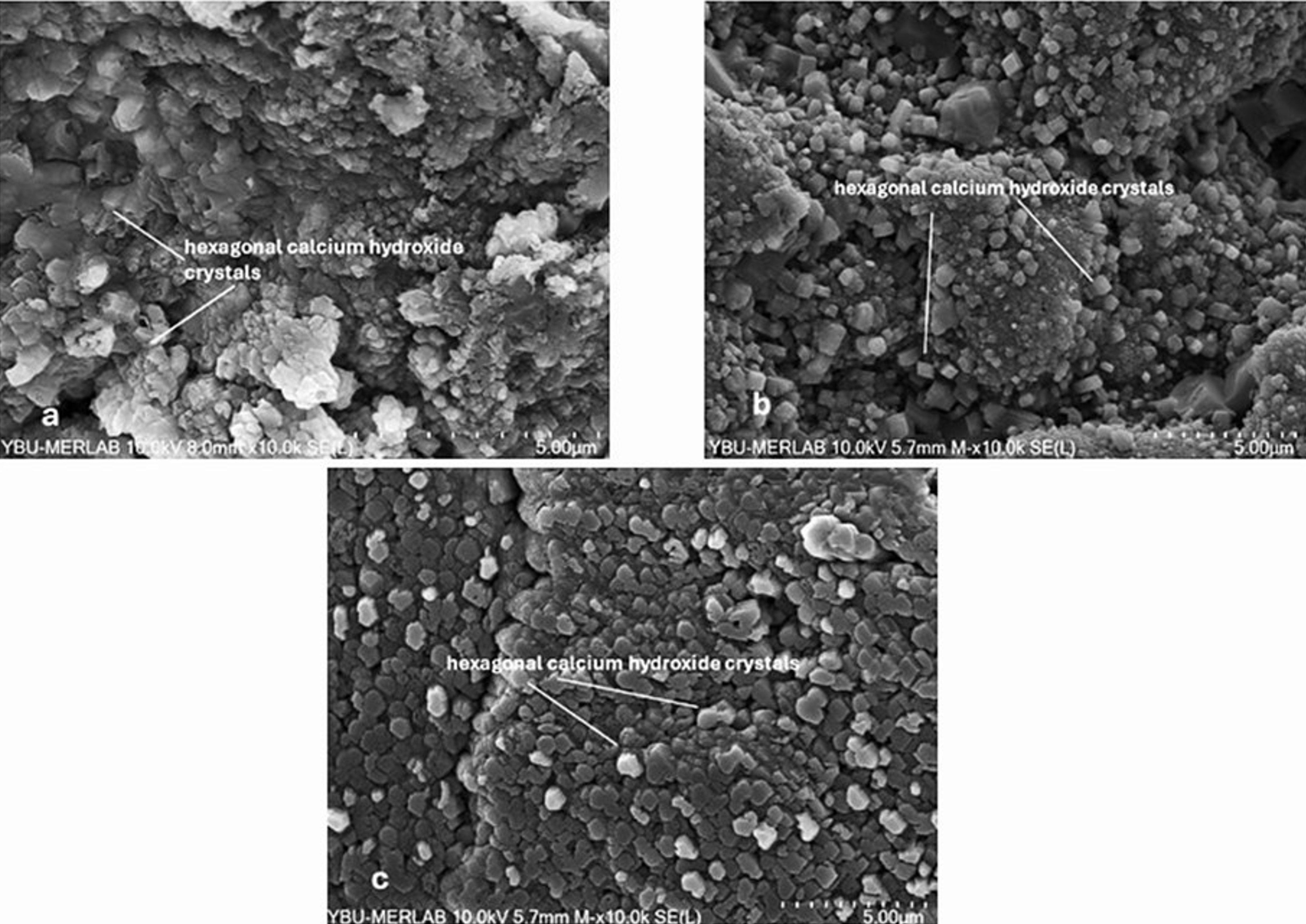 Surface morphology distribution based on FE-SEM analyses 
(10,000×). Representative FE-SEM images of MTA samples mixed with 
distilled water (control) (a), ozonated water (b), and propolis (c).