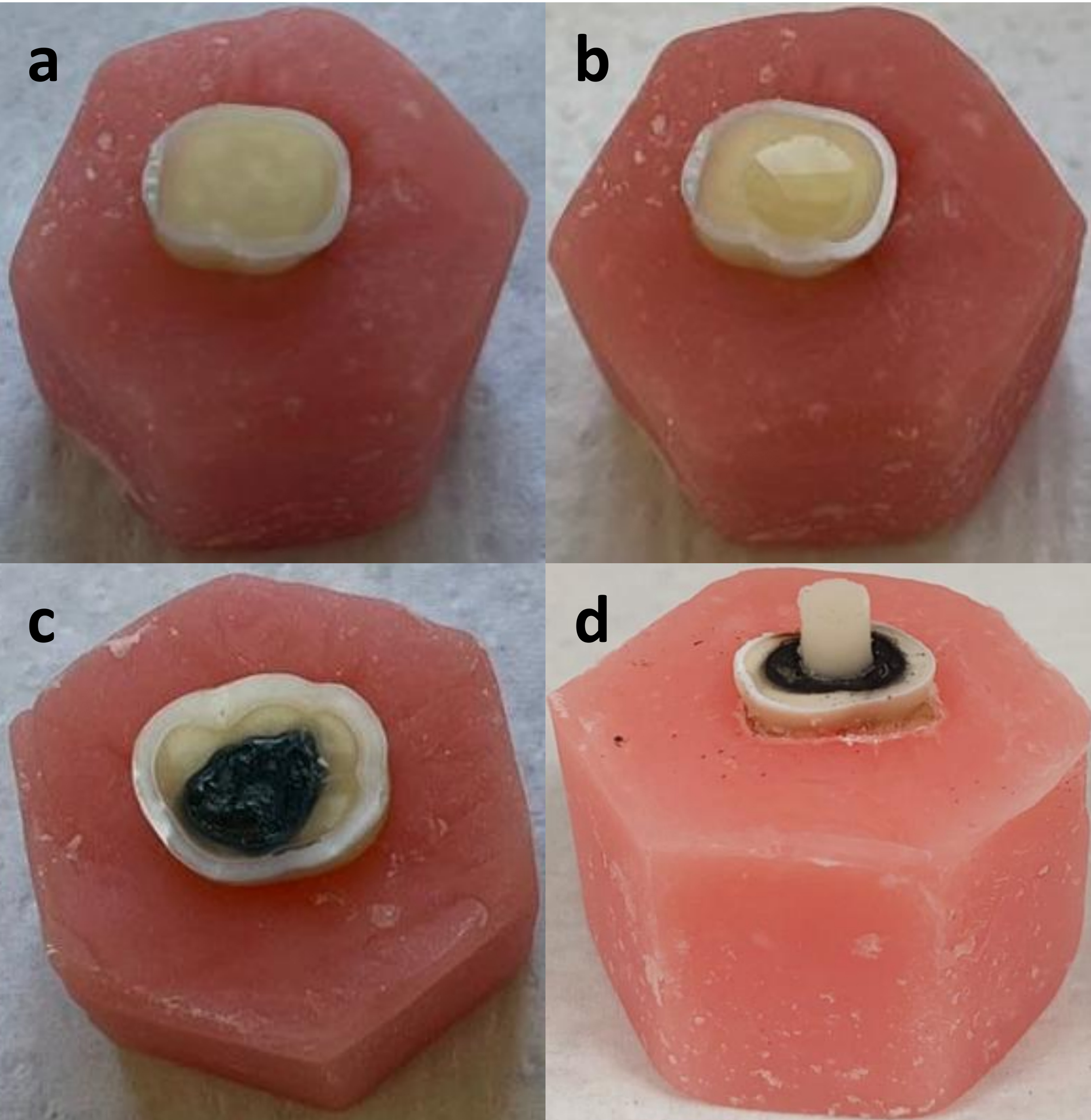 Specimen preparation and
treatment procedures. (a) Prepared dentin section embedded in acrylic resin. (b)
Application of SDF to the designated area. (c) Appearance of the dentin surface
after silver diamine fluoride (SDF) application. (d) Appearance of specimens
after restorative material application.