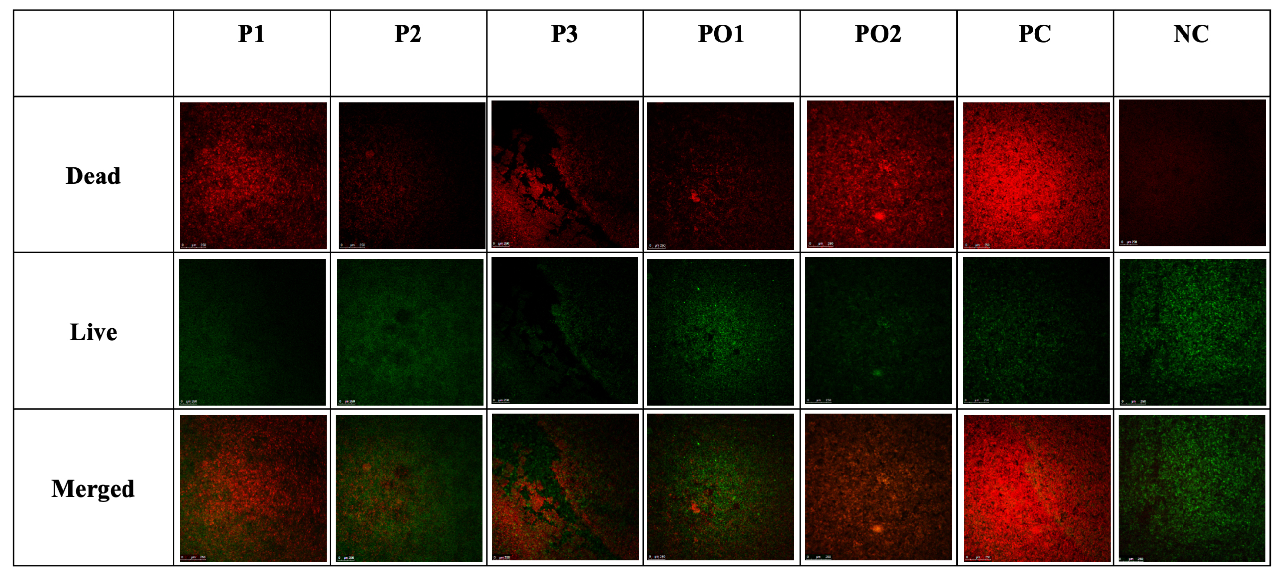 CLSM evaluation of live and dead bacterial distribution in
multispecies biofilms following toothpaste exposure. Representative confocal
laser scanning microscopy (CLSM) images of multispecies biofilms composed of
Streptococcus mutans, Lactobacillus casei, and
Scardovia wiggsiae formed on hydroxyapatite (HAP) discs after exposure
to different toothpaste formulations. The upper row (Dead) shows red fluorescence
indicating non-viable bacterial cells; the middle row (Live) shows green
fluorescence indicating viable bacterial cells; the lower row (Merged) represents
the overlay of live and dead signals. Increased red fluorescence and reduced
green fluorescence were observed in the fluoride-containing positive control (PC)
group, whereas the negative control (NC) group exhibited predominantly green
fluorescence, indicating higher biofilm viability. Scale bar = 250
μm. P1–P3, probiotic-containing toothpastes; PO1–PO2,
postbiotic-containing toothpastes; PC, positive control (fluoride-containing
toothpaste); NC, negative control.