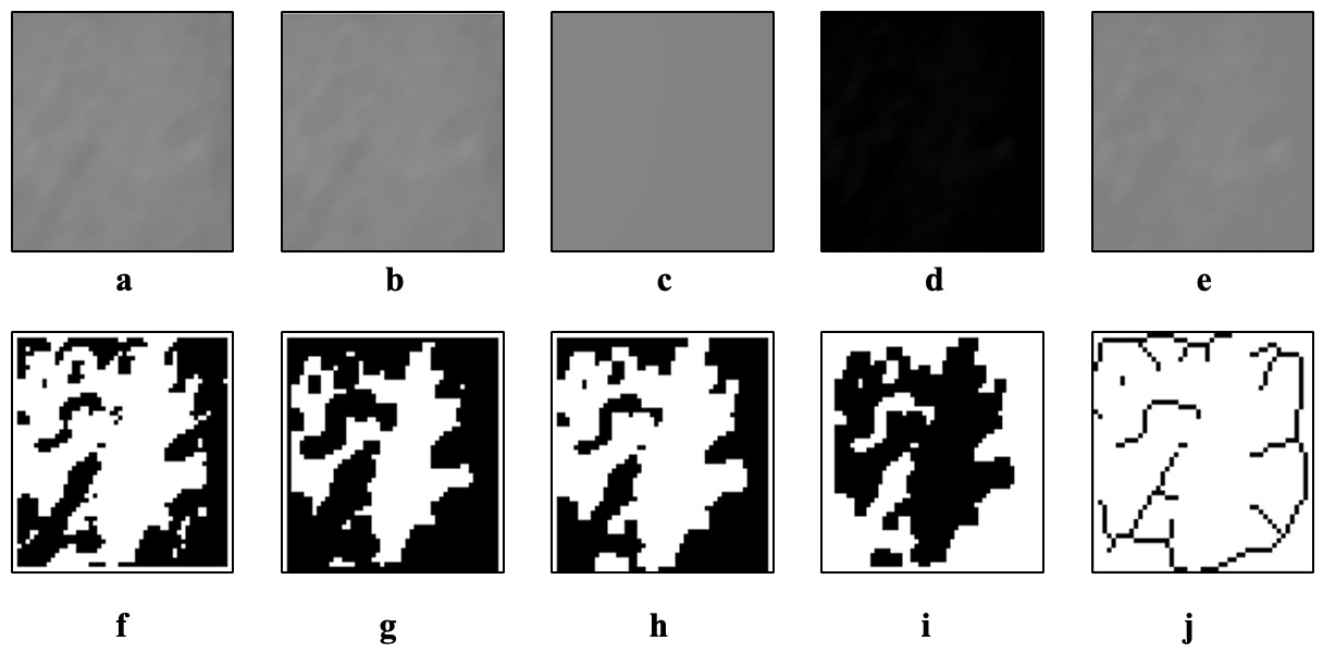 Fractal dimension analysis (FDA) procedure. (a)
cropping of the region of interest; (b) duplication; (c) Gaussian-blurred image
of the duplicated ROI; (d) subtraction of the blurred image from the original
image; (e) addition of 128 gray values; (f) binarization; (g) erosion; (h)
dilation; (i) inversion; (j) skeletonization.