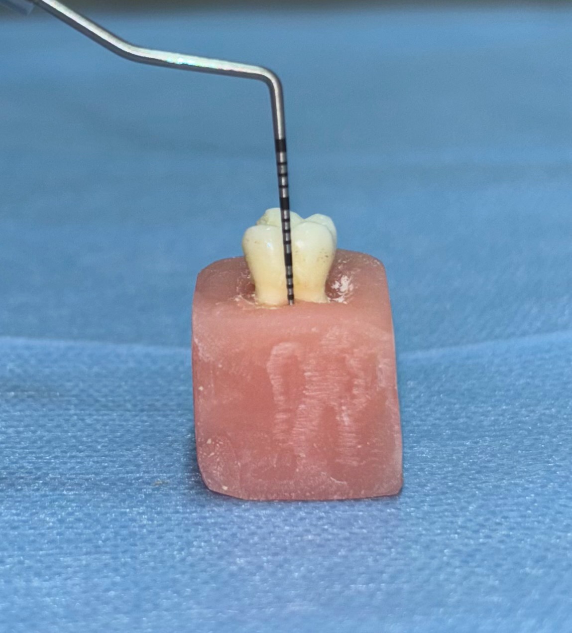 Embedding of the primary molar specimen 2 mm below the
cemento-enamel junction.