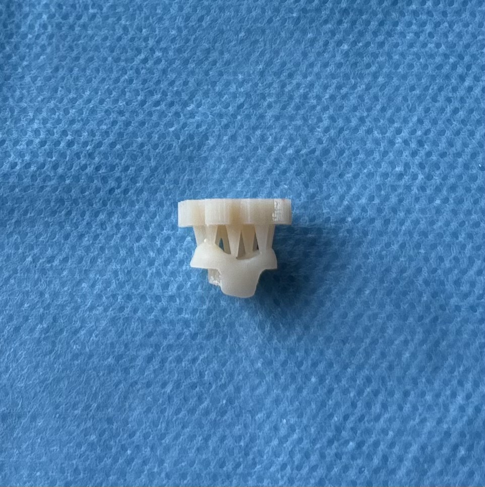 3D-printed restoration before removal from the supporting
structures.